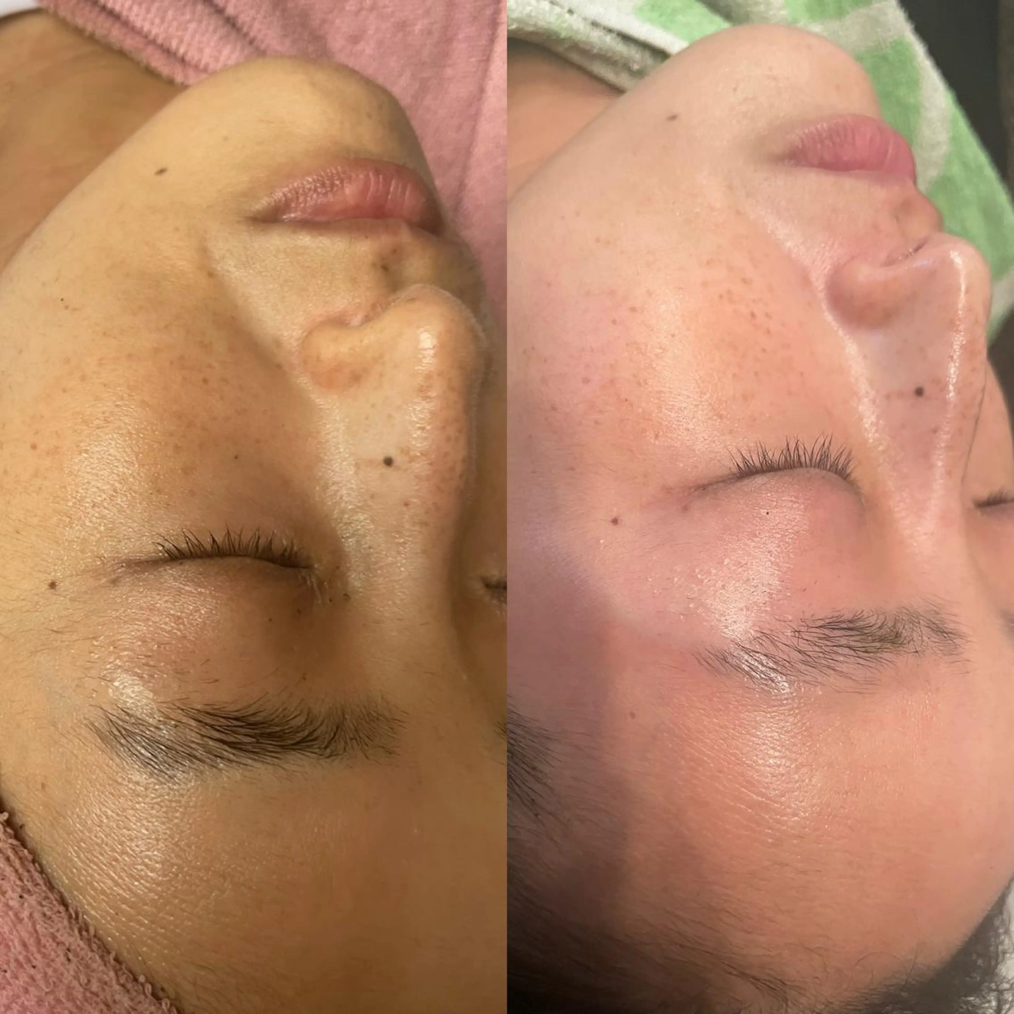 beauty lanaのエステ・リラクイメージ