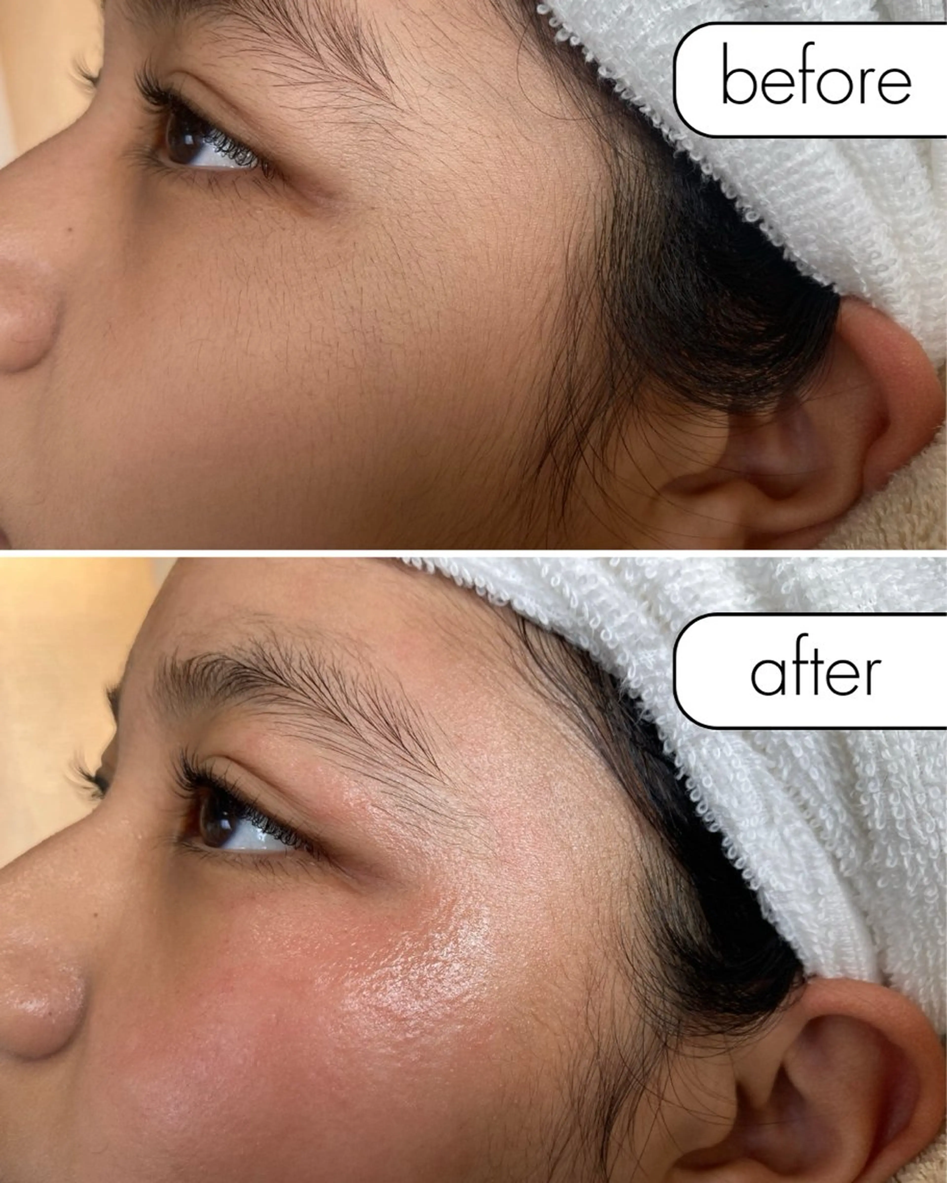 脱毛 蝶式糸除毛専門salon aco所属・糸除毛専門salon acoのエステ・リラクイメージ