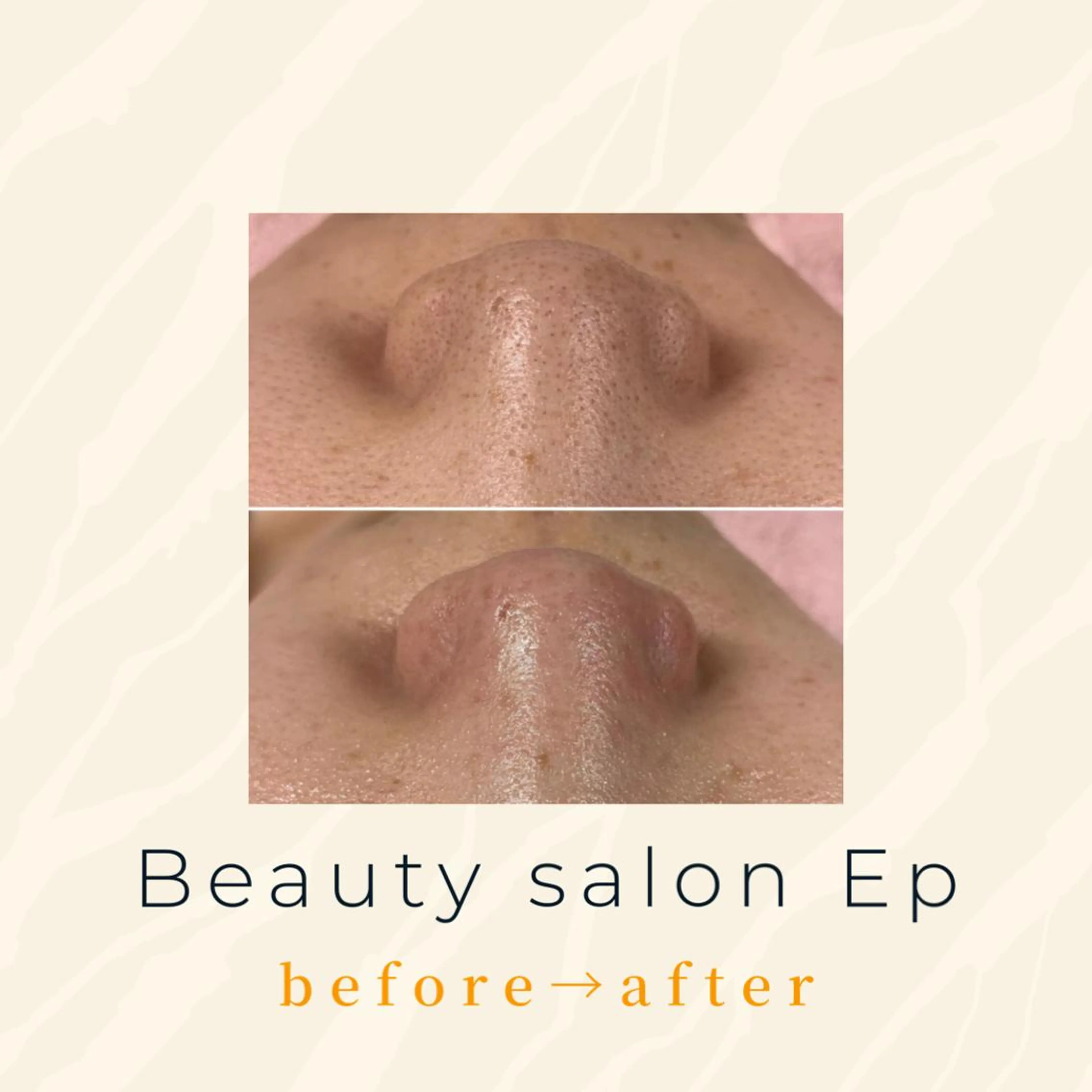 メンズ beauty salon  epのエステ・リラクイメージ