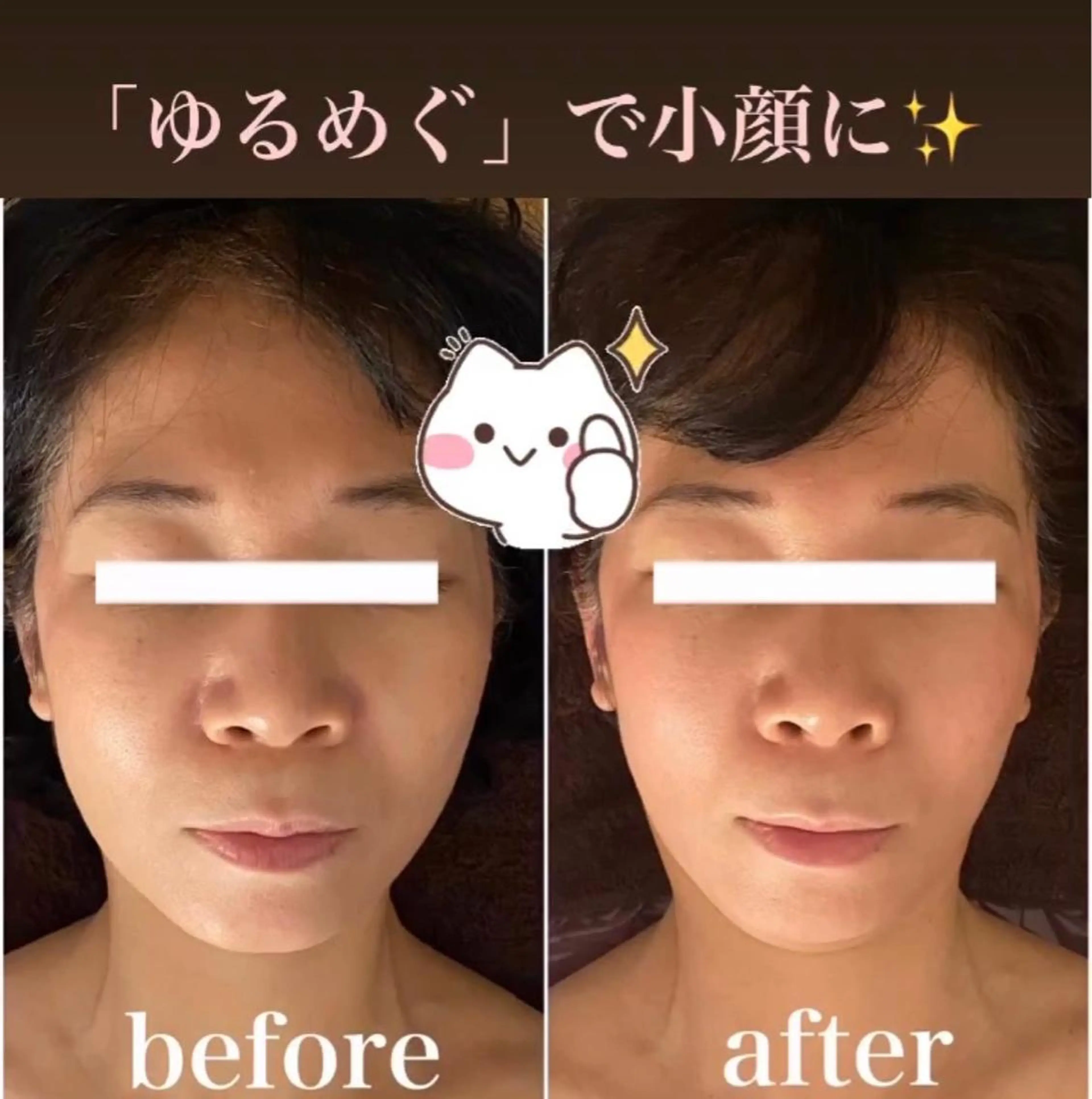 【プレミアム小顔矯正】小顔矯正+首・肩・背中・腕・頭ボディトリートメント+頭蓋骨マッサージ☆お顔も身体も頭もスッキリ！の写真