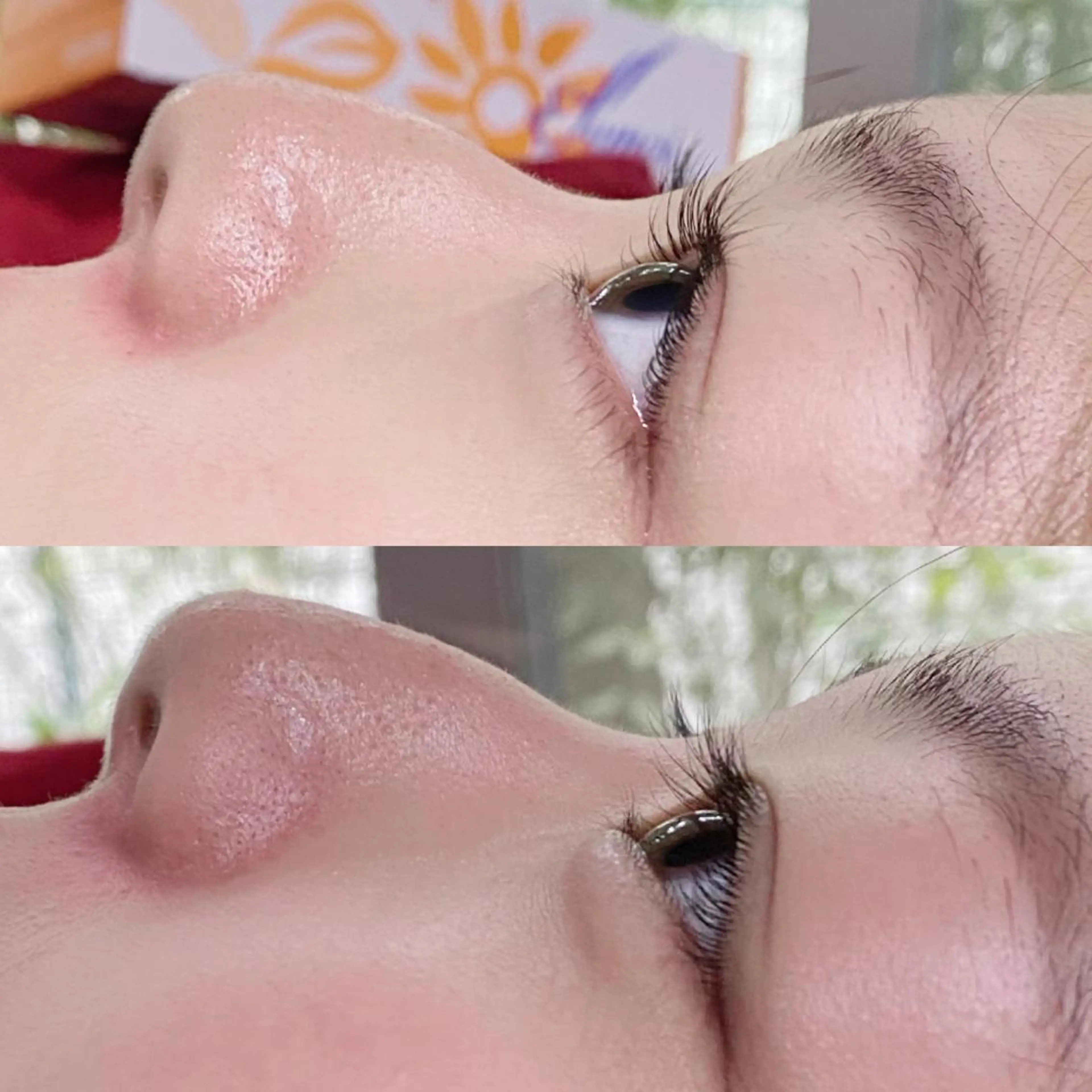 マツエク・マツパ まつげ、毛穴 TREEのエステ・リラクイメージ