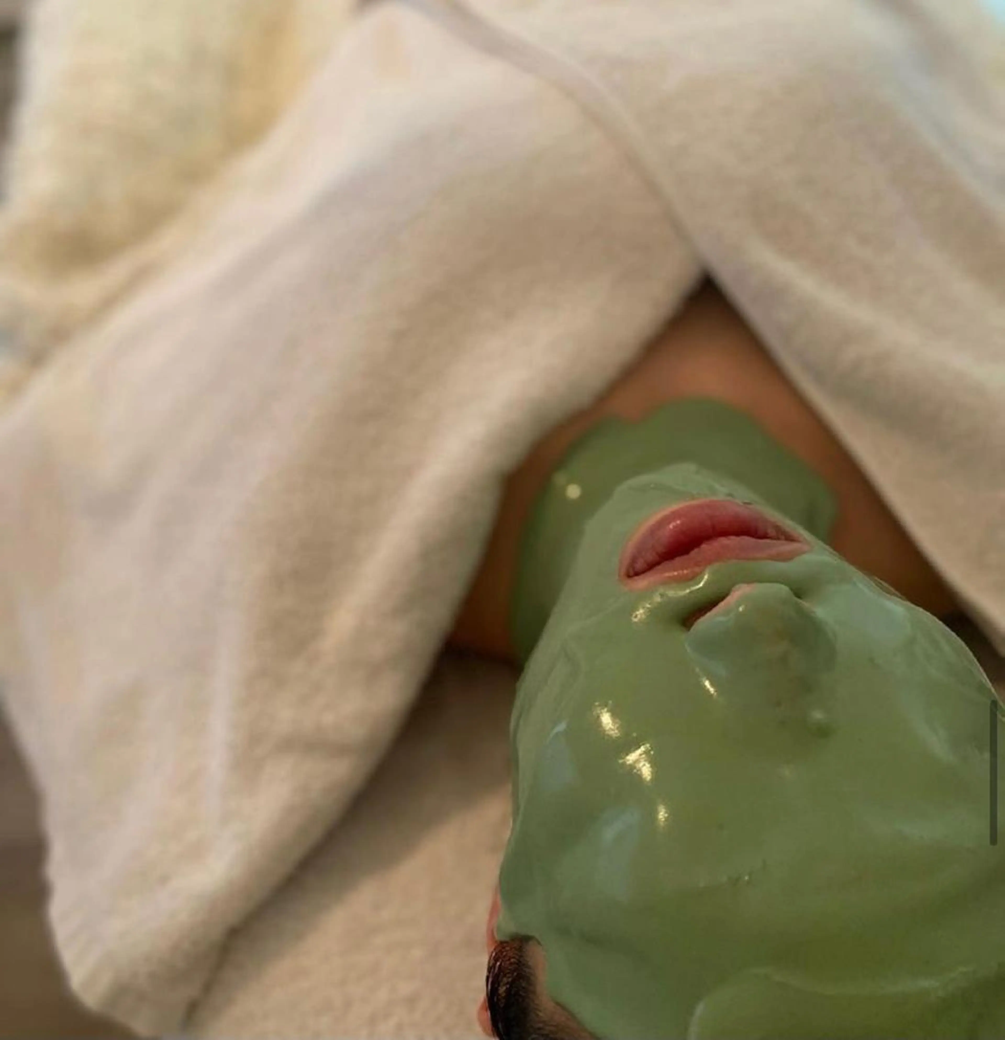 肌荒れ・ニキビが気になる方に★ビューネケアパック&スタンダードコースの写真