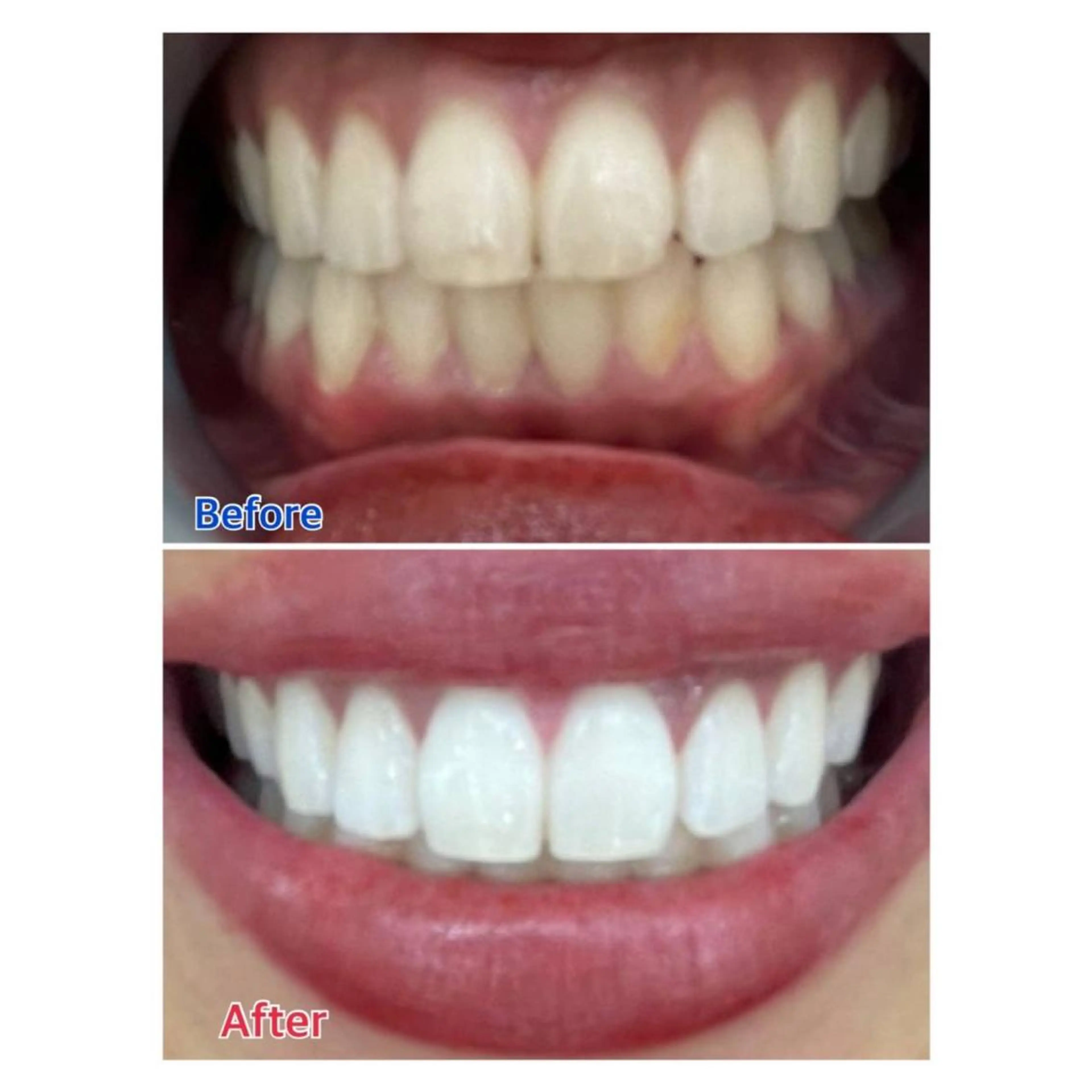 MBEAUTYSALON 千葉店・京成大久保所属・Melty 輝のその他イメージ