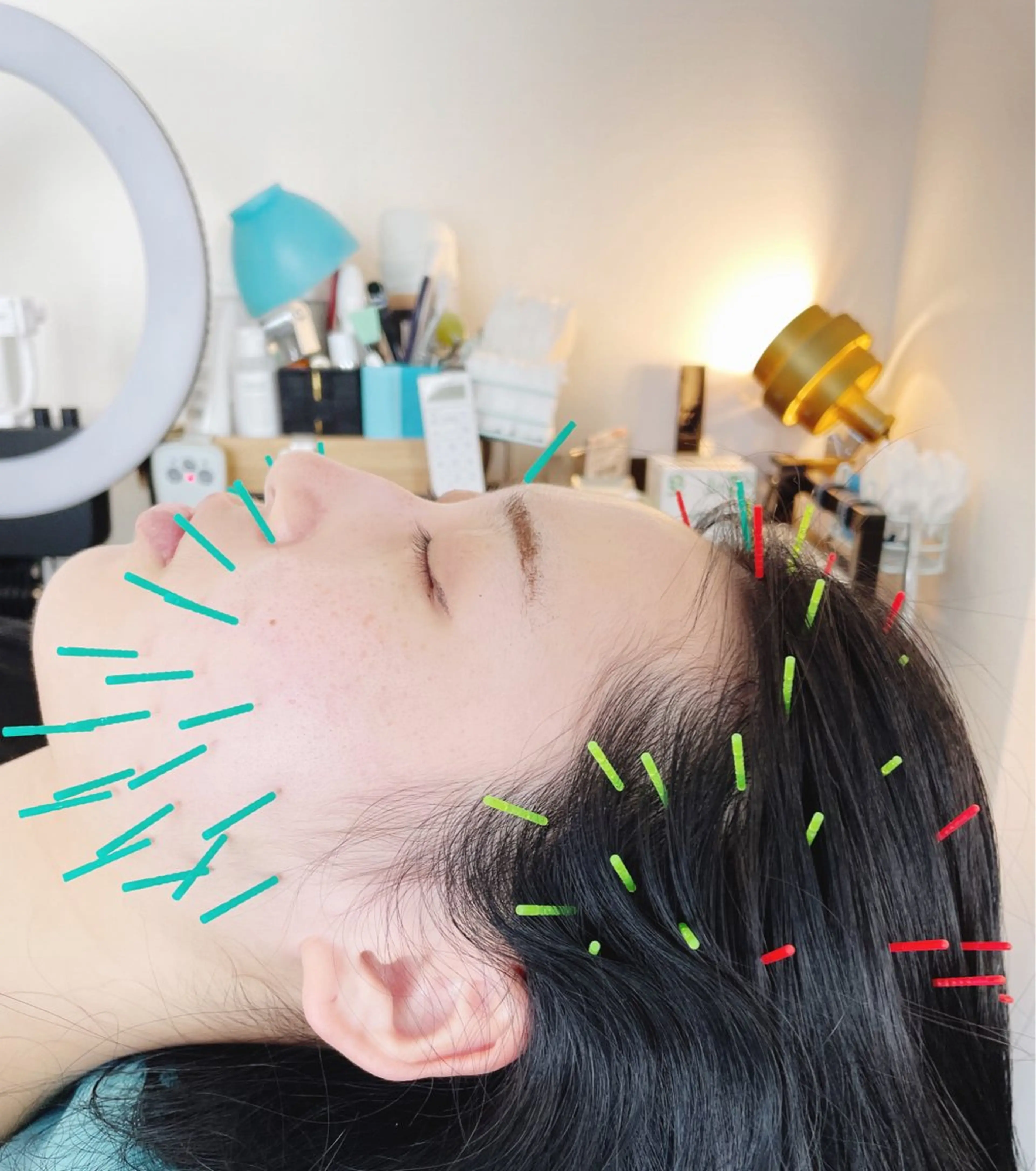 小顔美容鍼専門サロン 渋谷YZのエステ・リラクイメージ