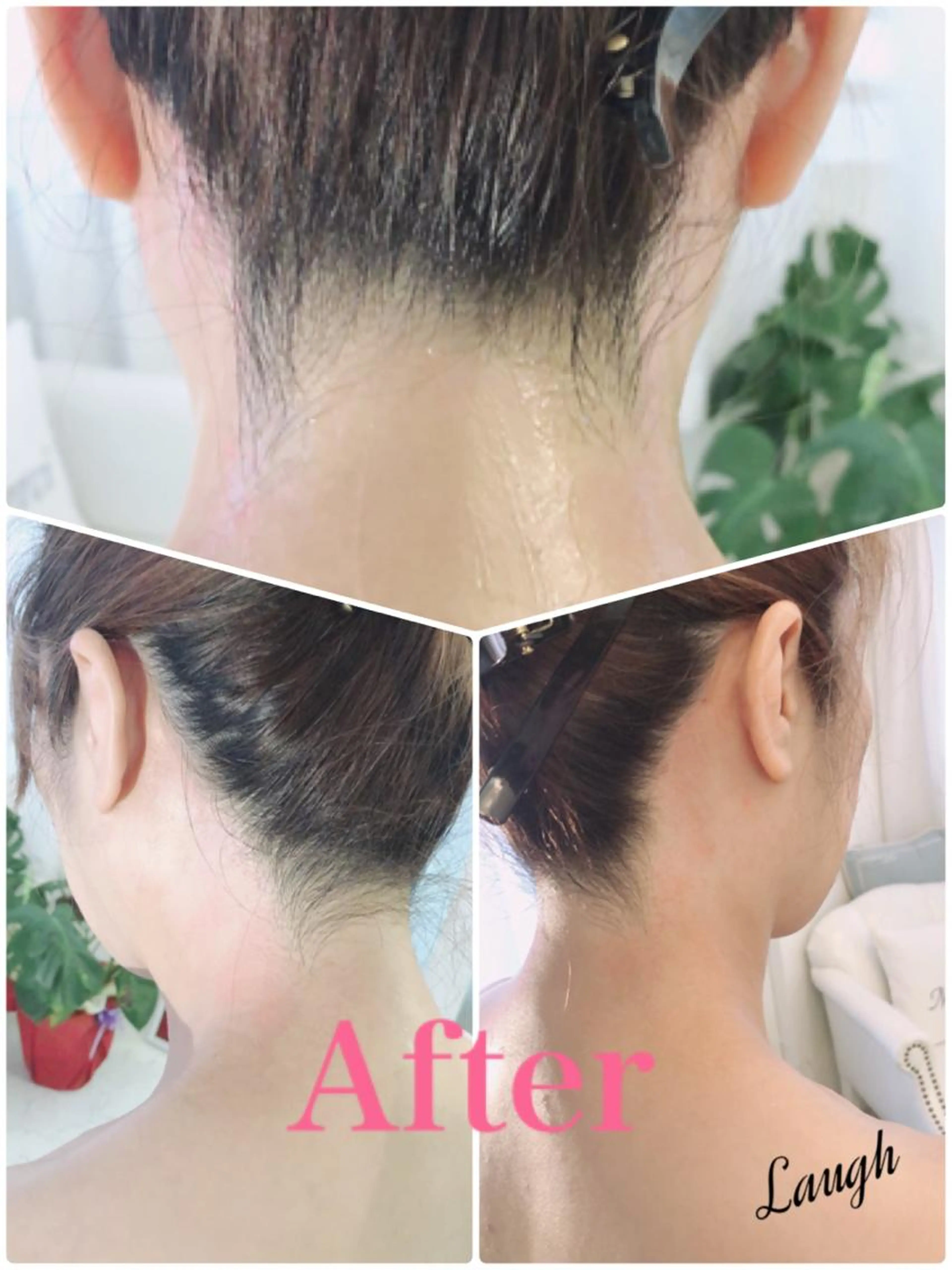 女性☆うなじwax脱毛☆モニター　※4/2より価格変更致します。1000→1500の写真