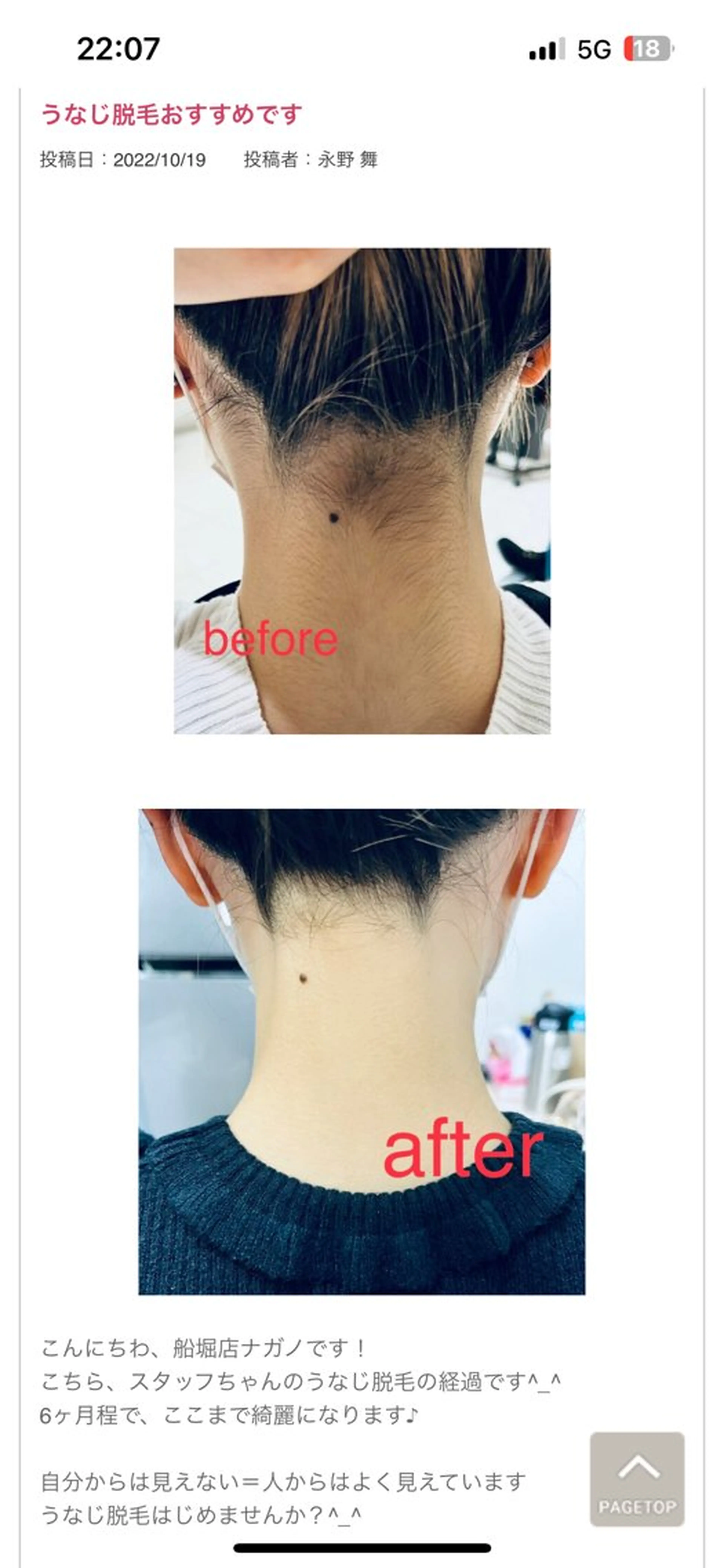 脱毛フェイシャル痩身 エリア最安👑永野舞のエステ・リラクイメージ