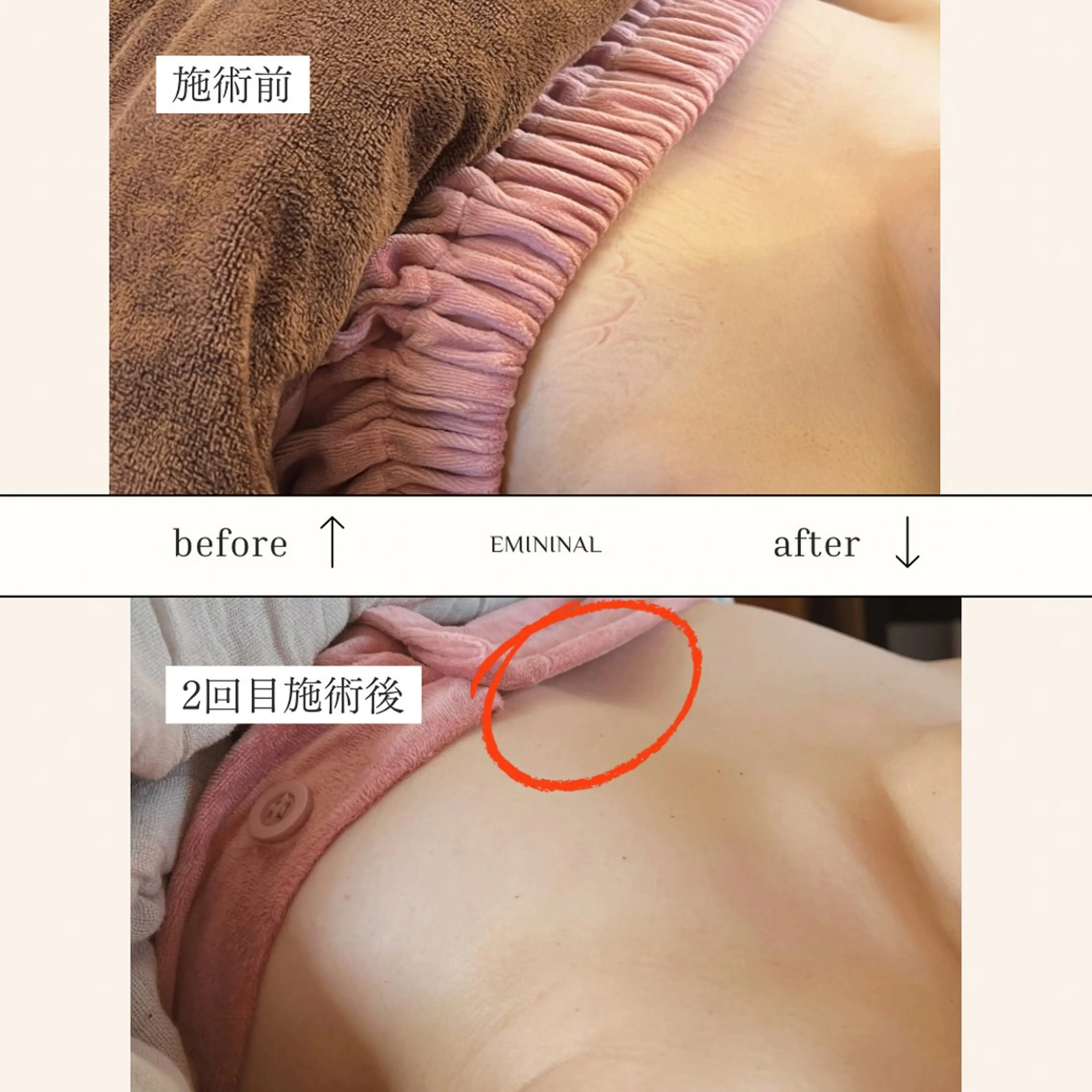 EMININAL salon所属・鈴木 映子のエステ・リラクイメージ