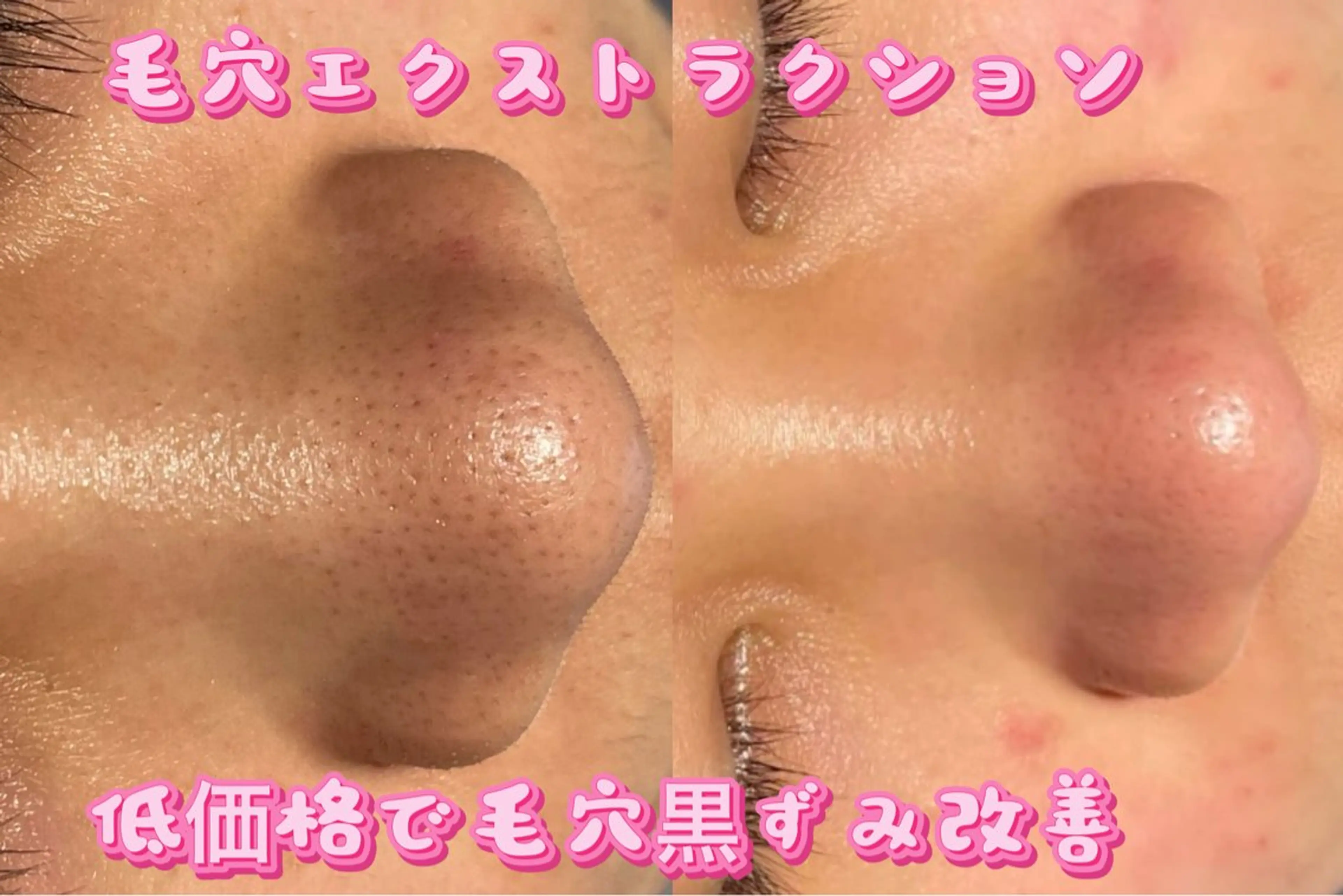 Beauty Zion所属・Beauty Zionのエステ・リラクイメージ