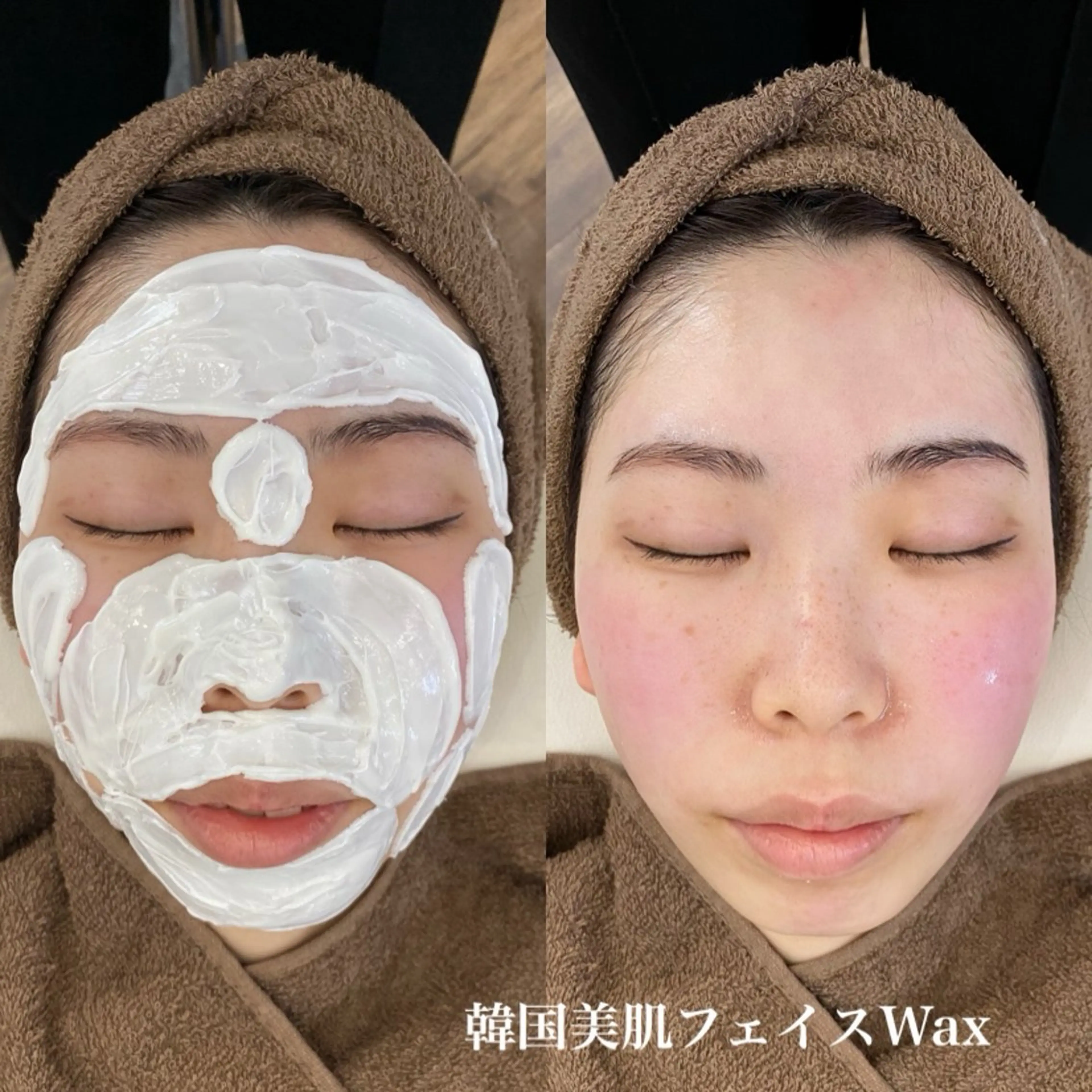 脱毛 white eye 西宮北口店所属・WHITE EYE 🦋松島のエステ・リラクイメージ