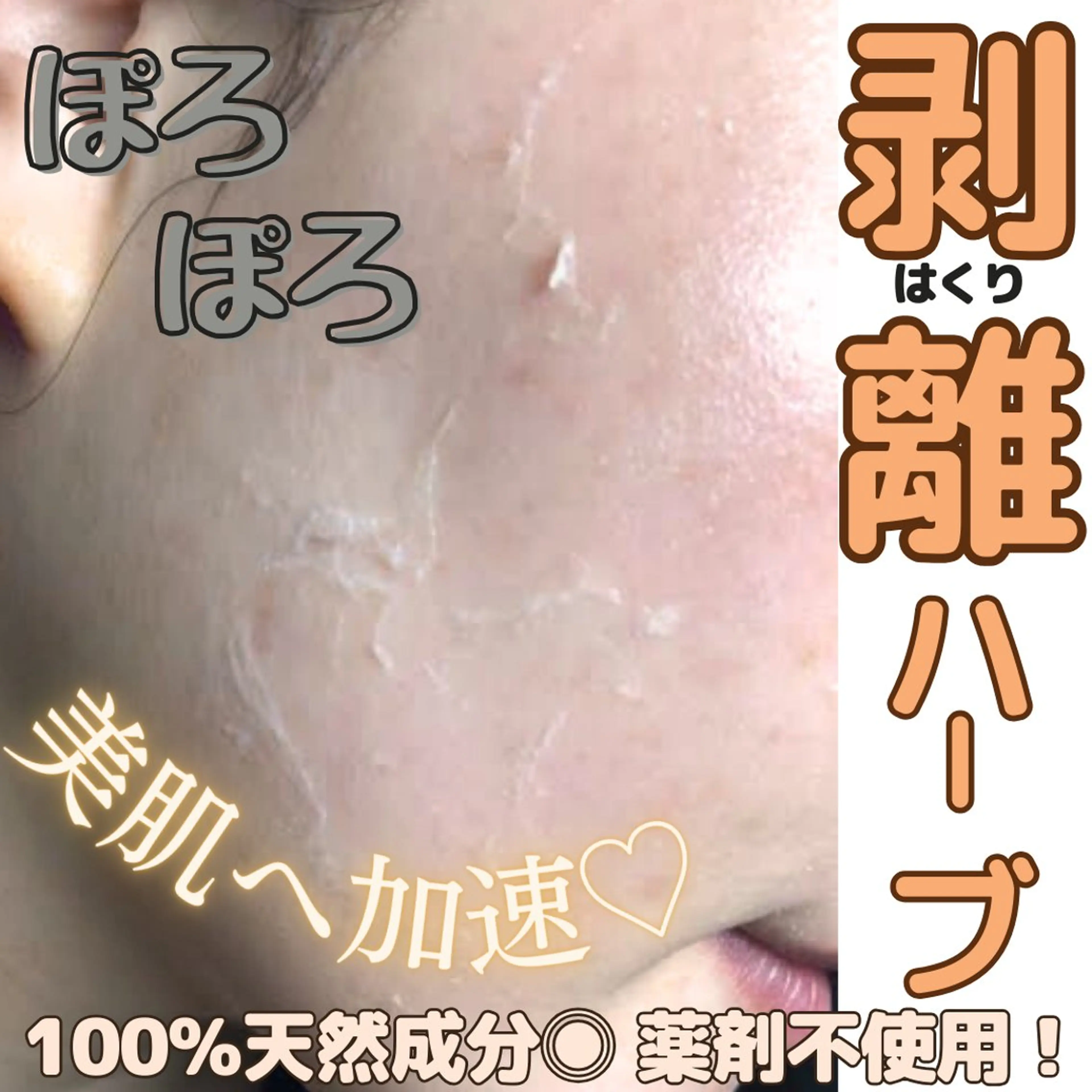 【剥離ハーブピーリング🌿】美肌へワープ◎導入美容アフターケア込み🪄《約１週間後⇒再来店》お得な２回来店価格の写真