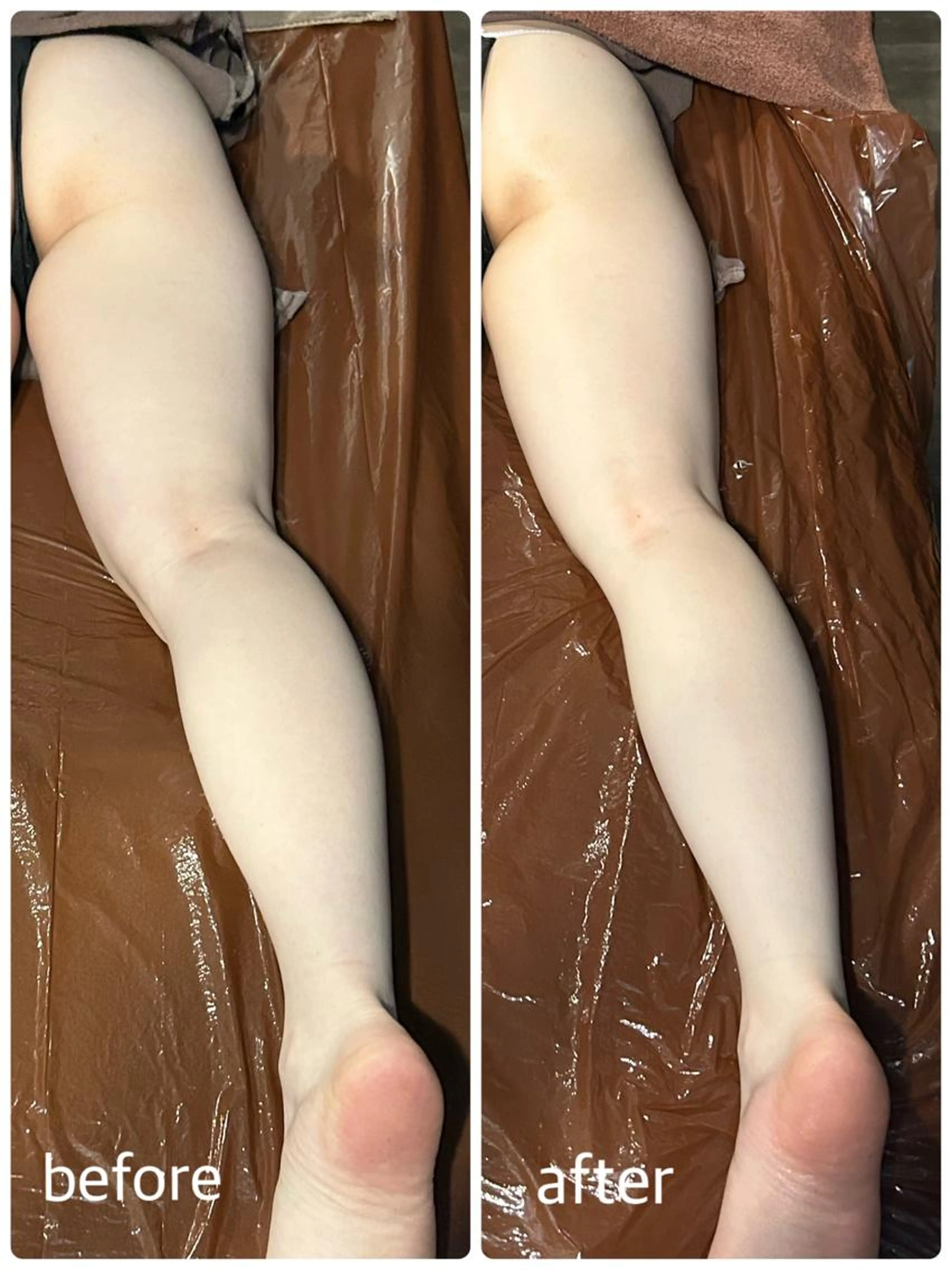 脚痩身エステ✨キャビテーション＋ラジオ波→マッサージ💕60分の写真