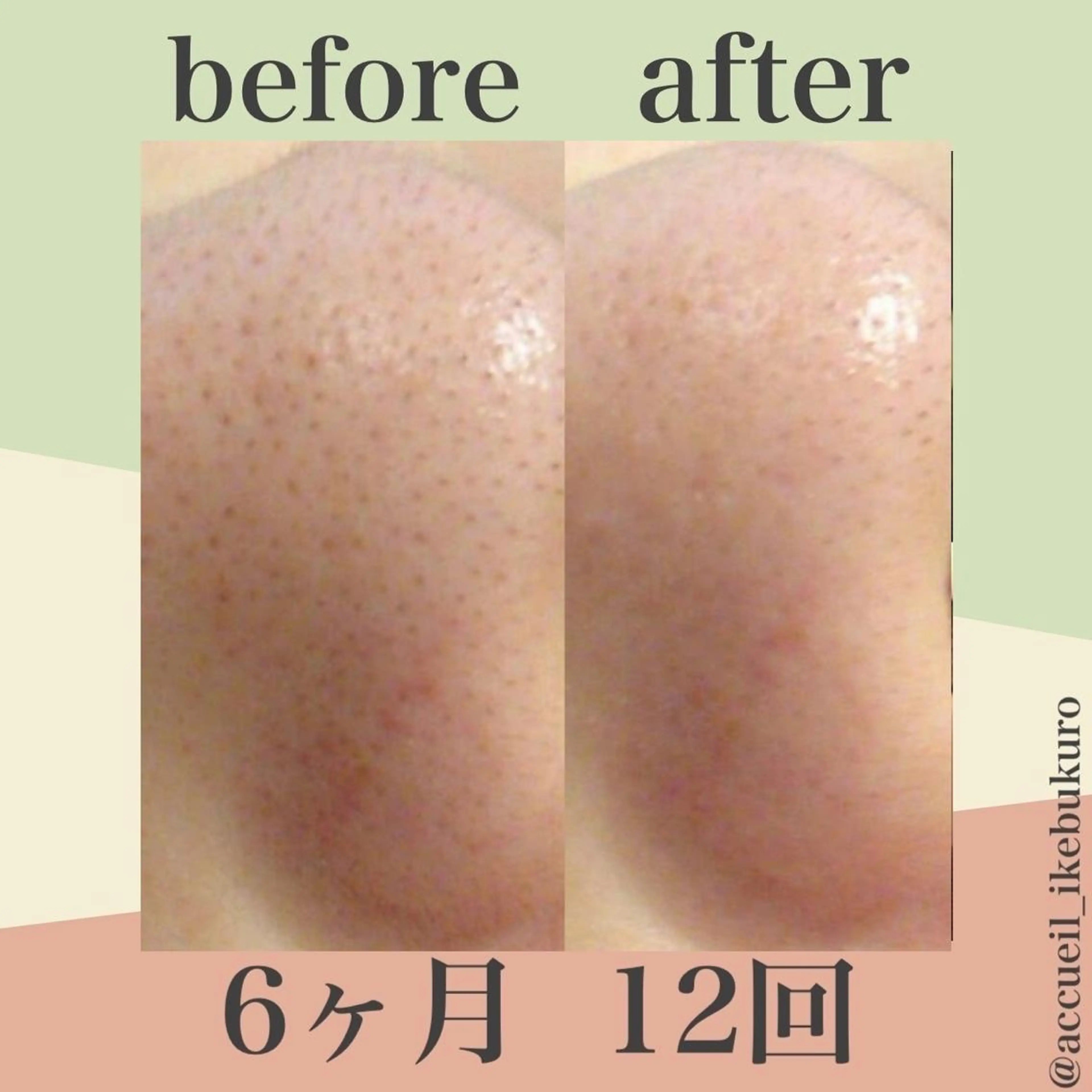 ミディアム カラー パーマ ヘアアレンジ メンズ キッズ ネイル マツエク・マツパ エステ リラク ニキビ・肌質改善専門 ♡人生が変わるサロンのエステ・リラクイメージ