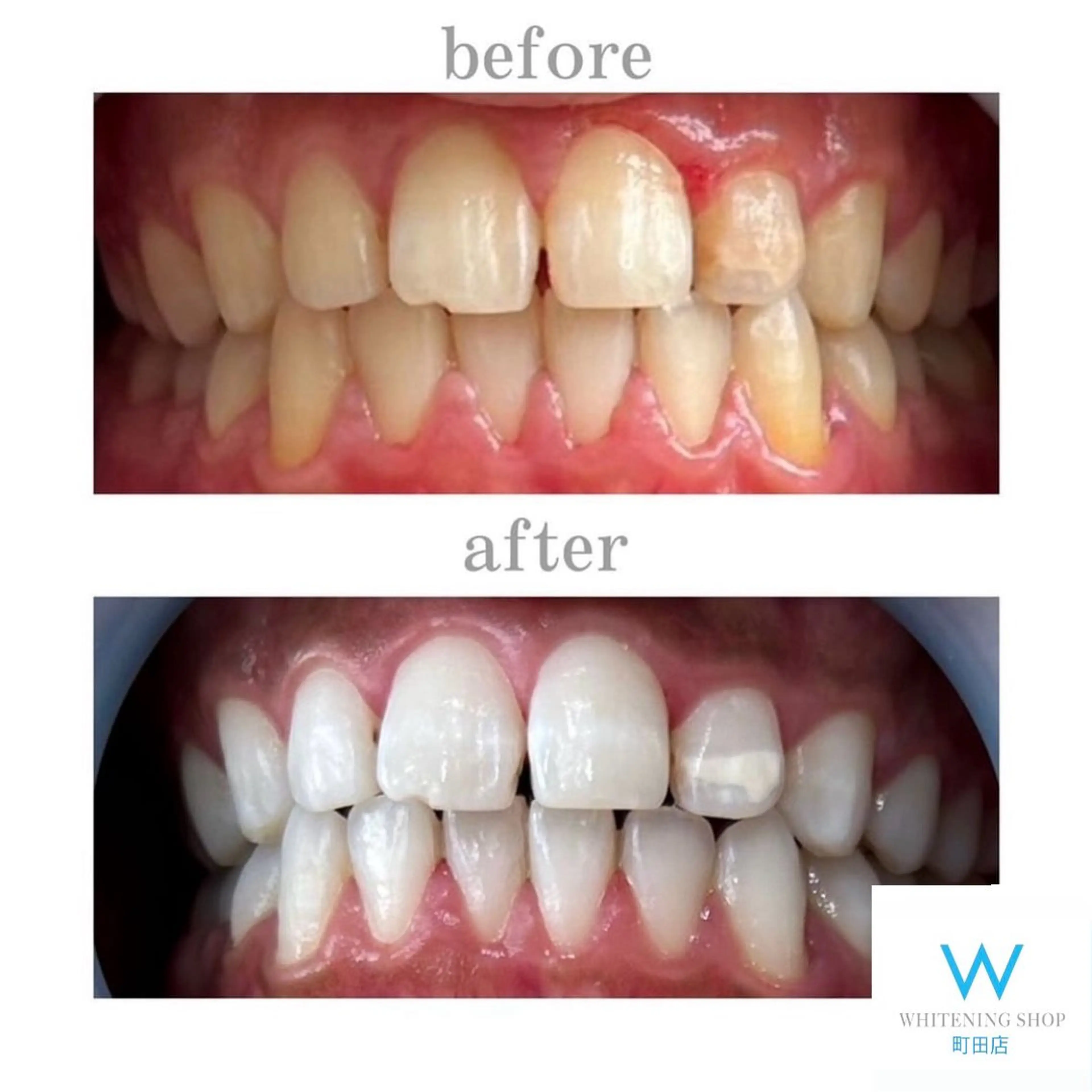 メンズ キッズ その他 ホワイトニング ショップ町田店のその他イメージ