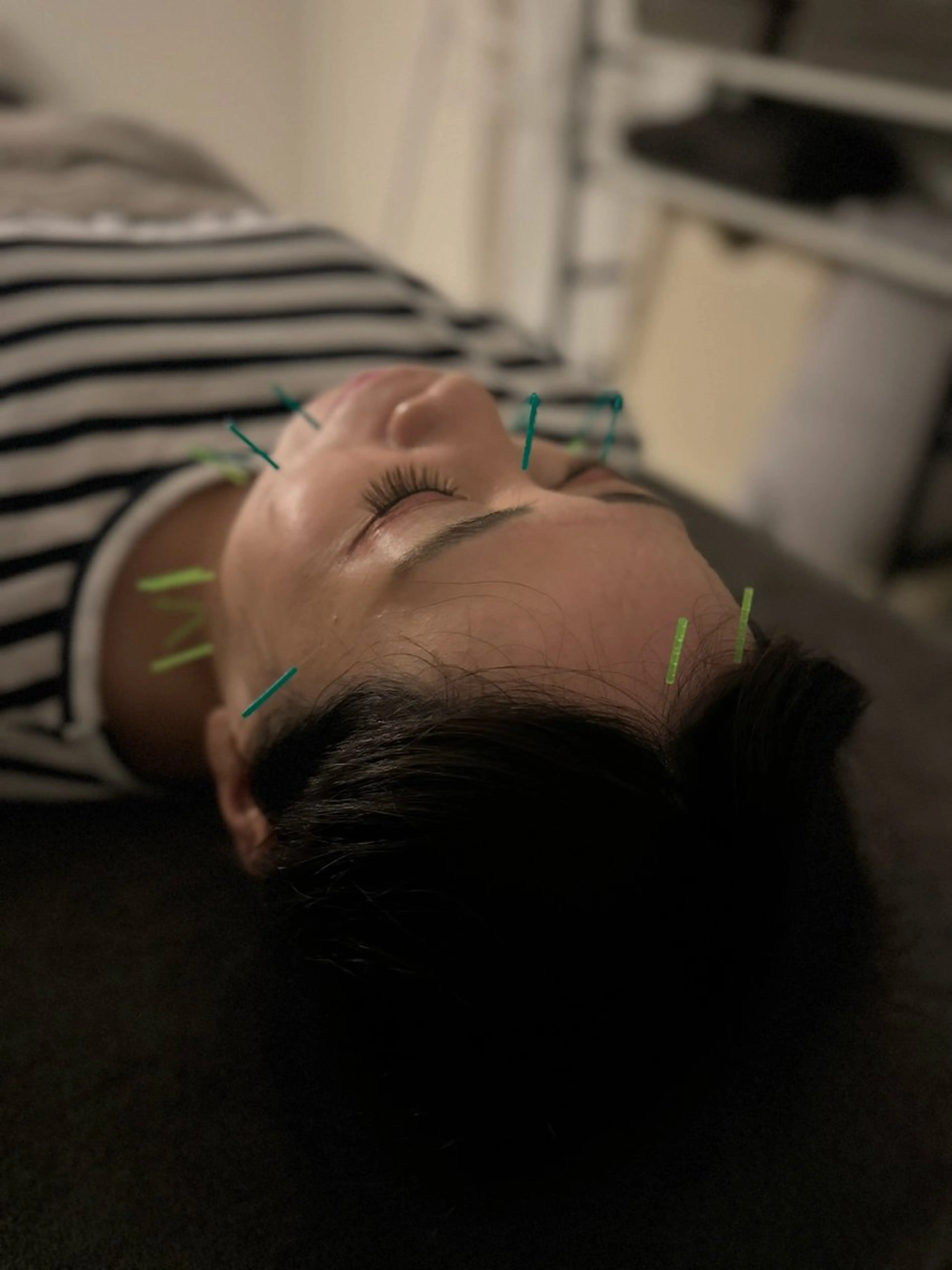 美容鍼×小顔矯正 ×美容整体　浜川泰仁のエステ・リラクイメージ