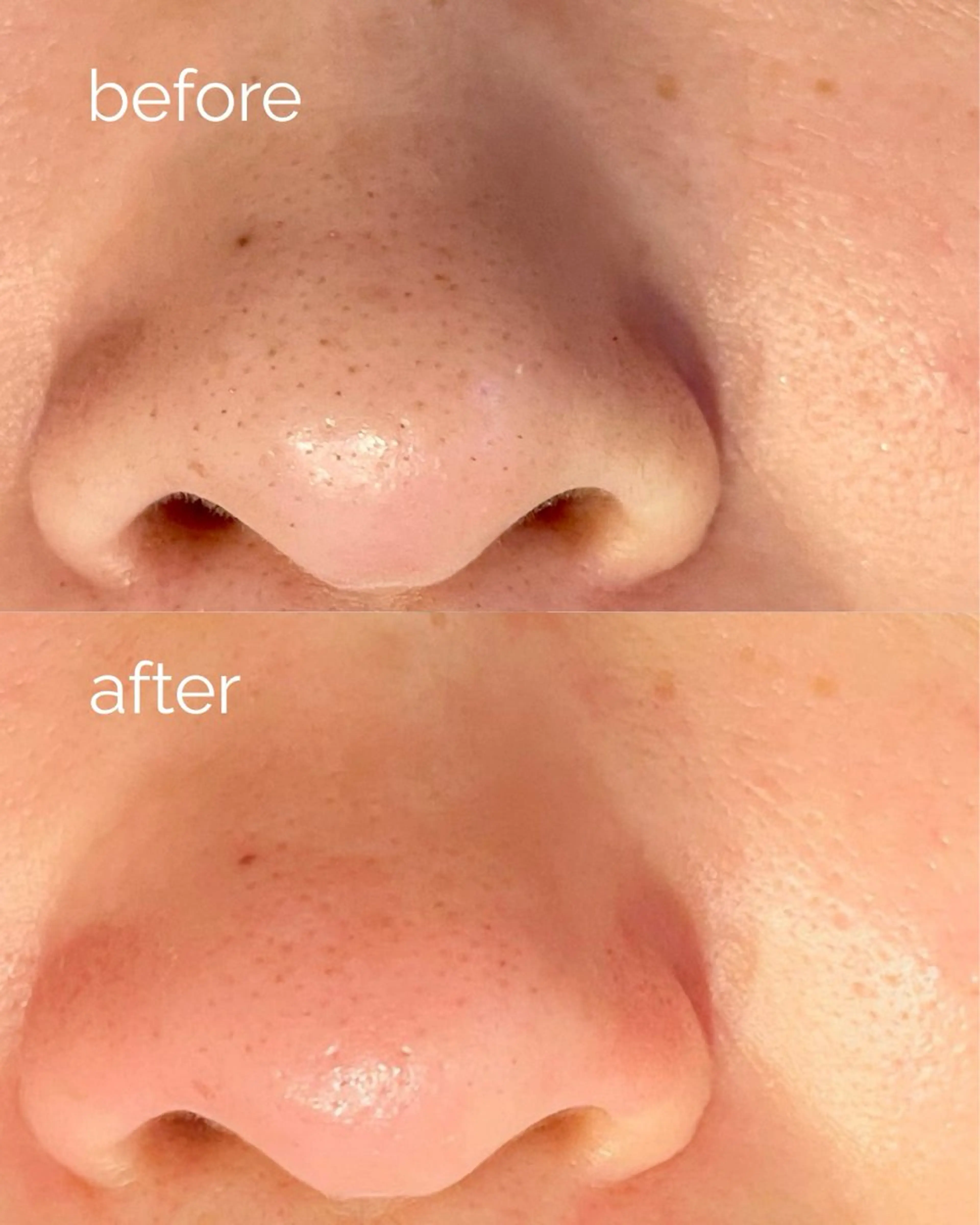 毛穴ケア専門サロン m&uのエステ・リラクイメージ