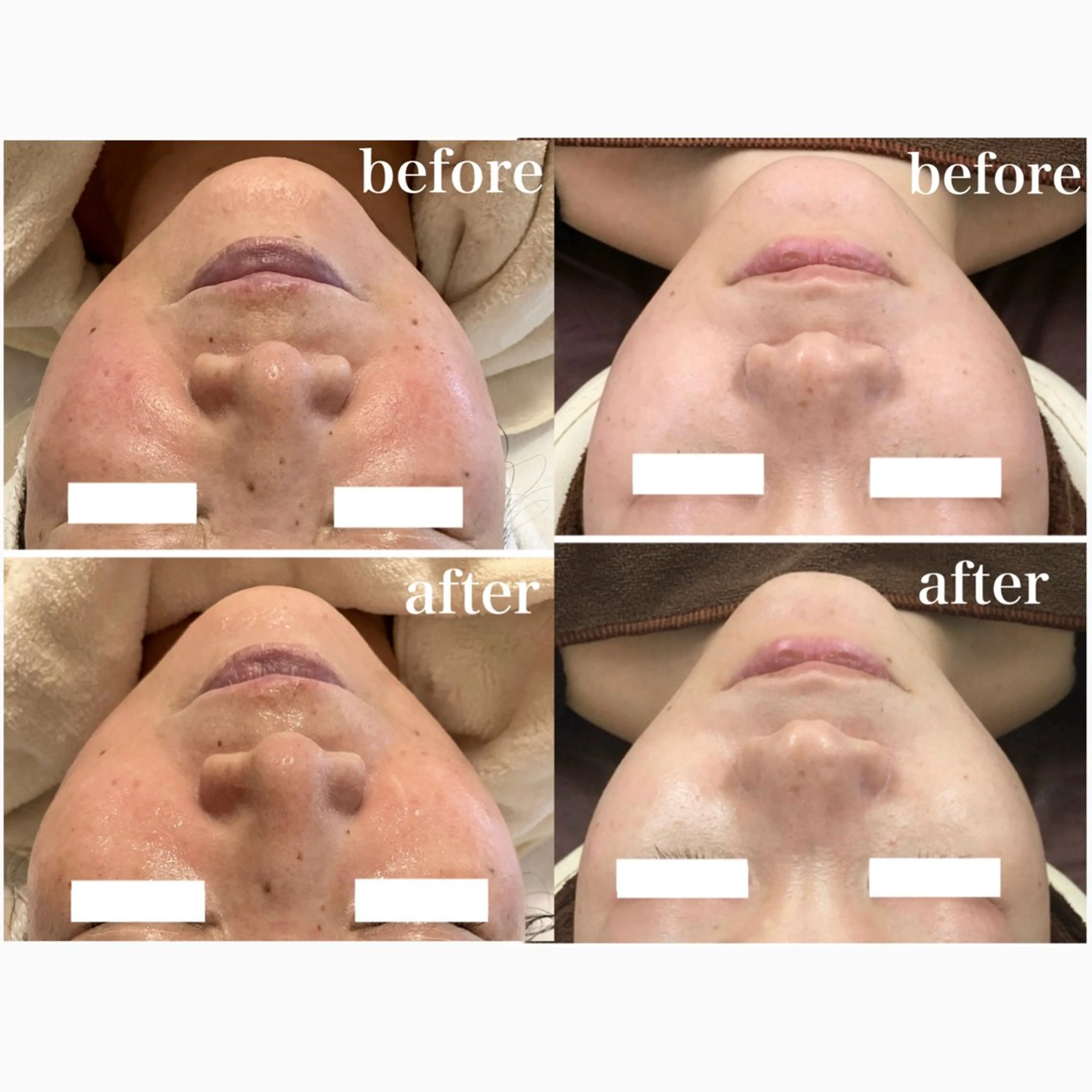 Lily branc 痩身/小顔/肌質改善のエステ・リラクイメージ