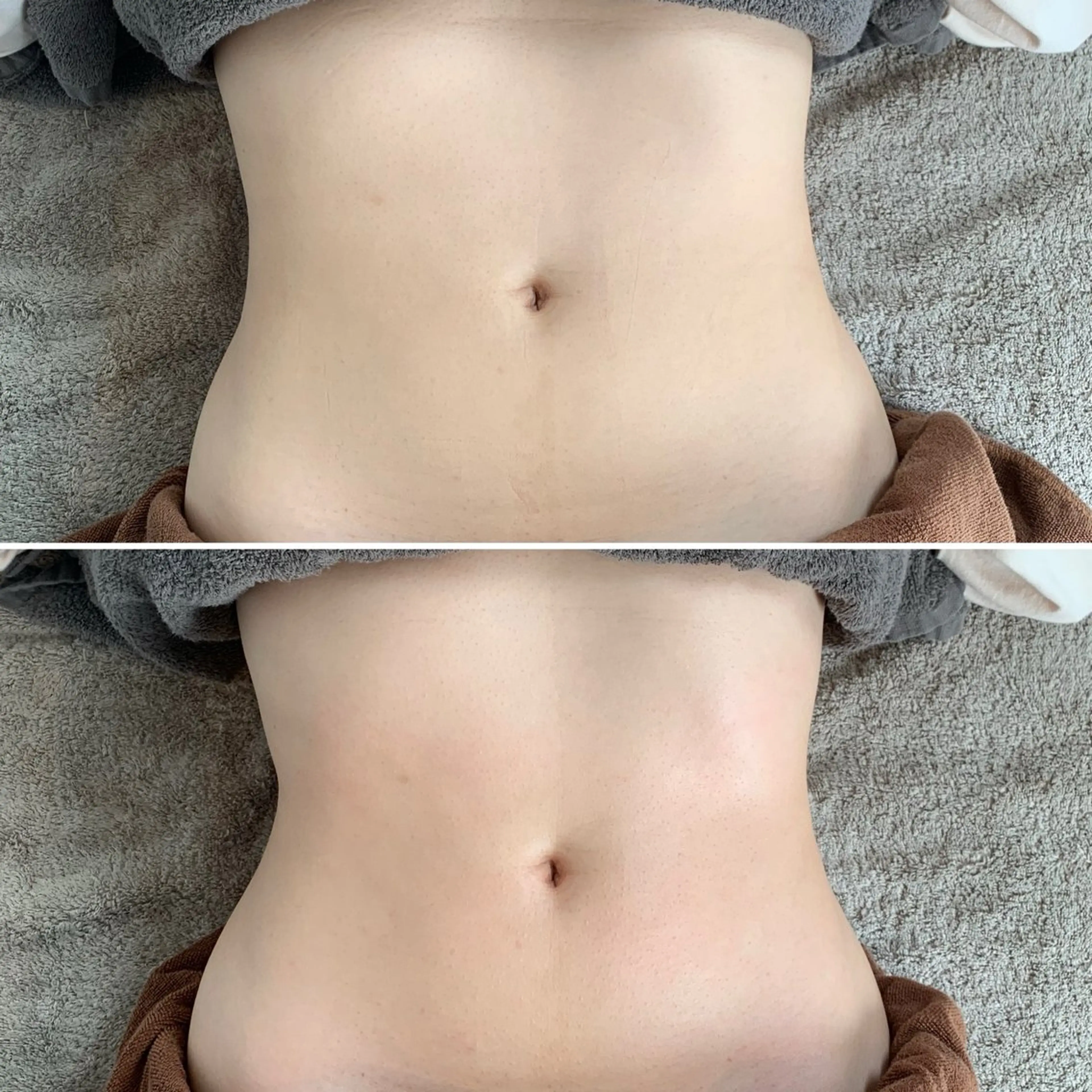 RiciL リシルのエステ・リラクイメージ