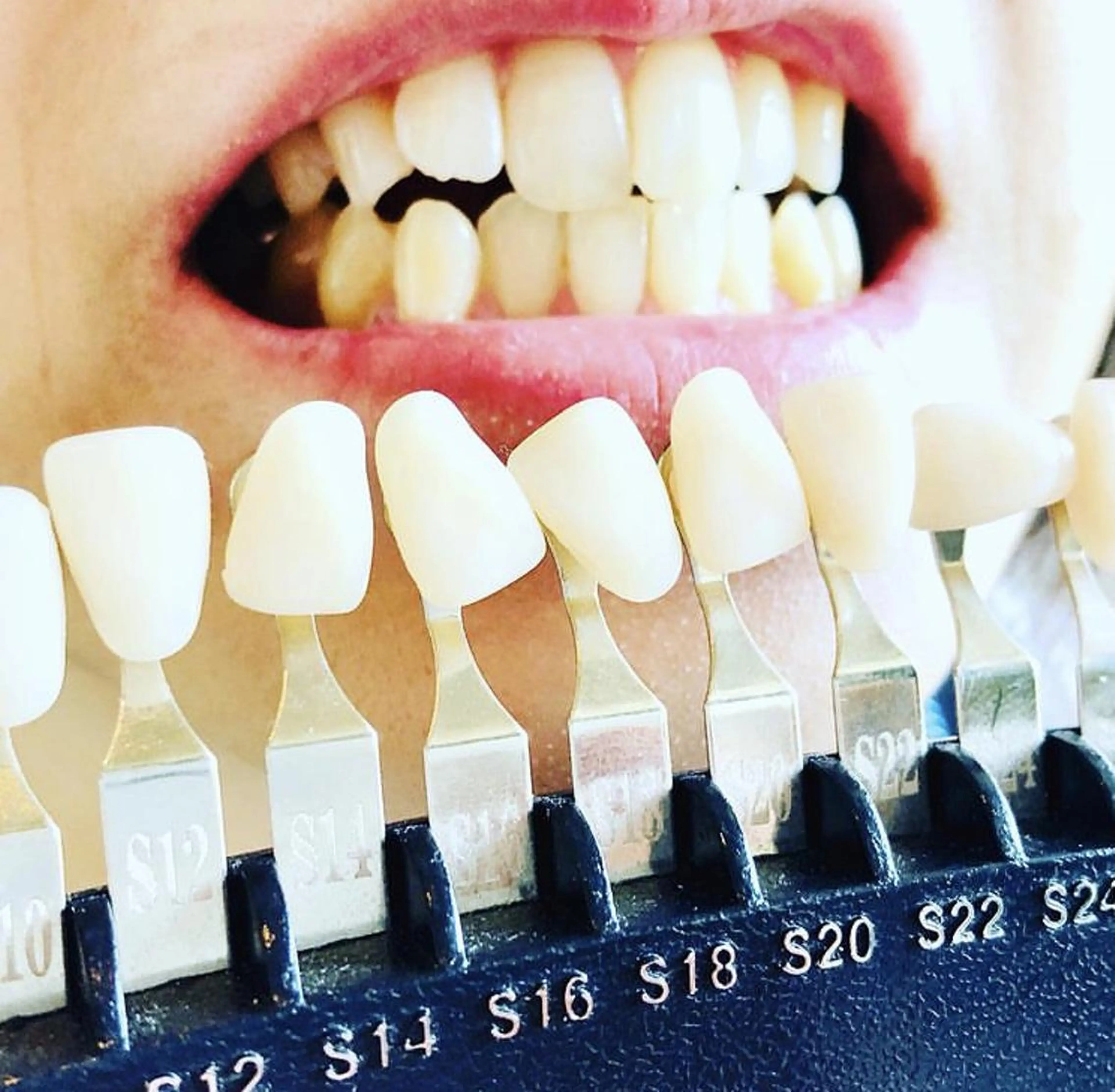 エステ ブランエミュ 池袋本店のエステ・リラクイメージ