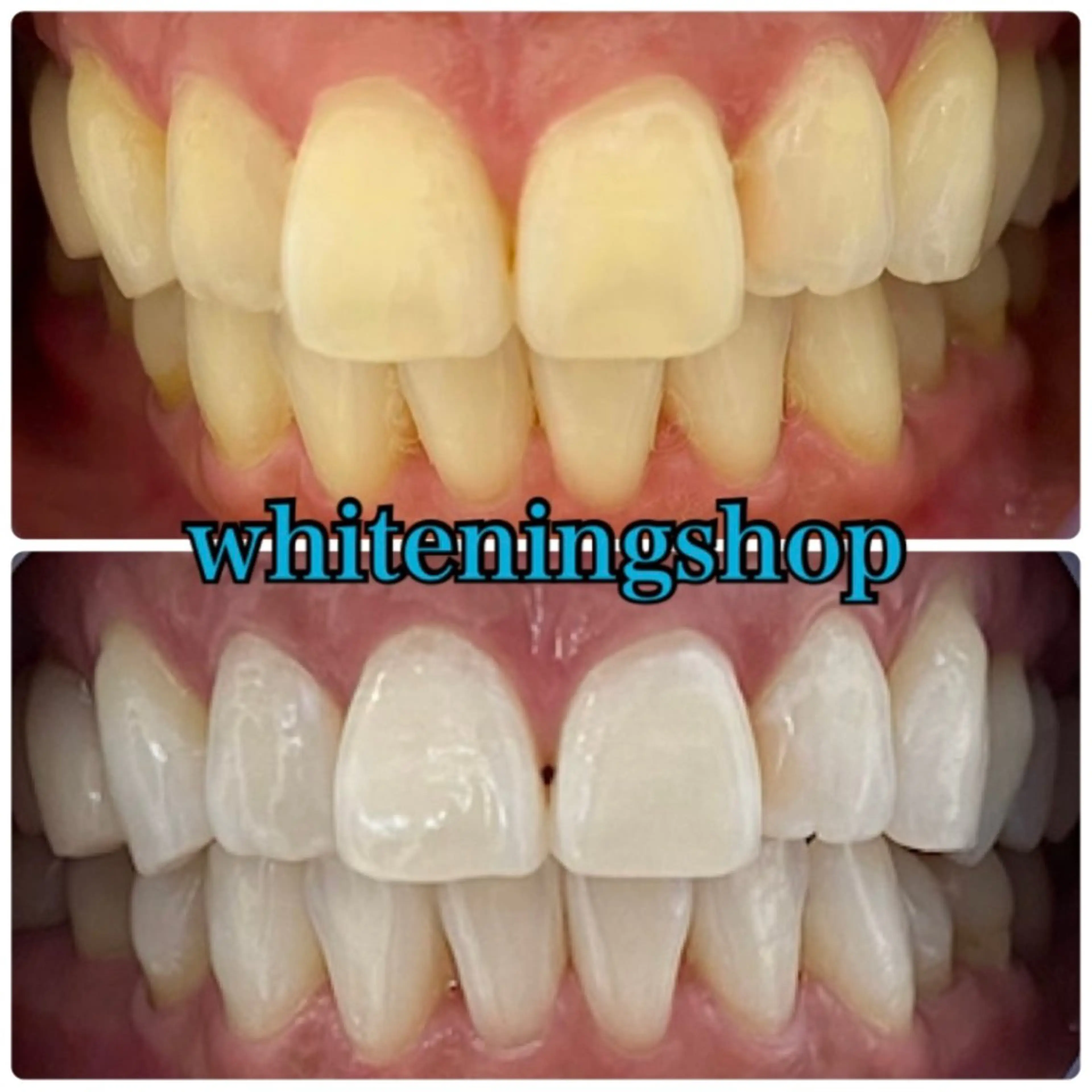 エステ リラク ホワイトニング ショップ吉祥寺店のエステ・リラクイメージ