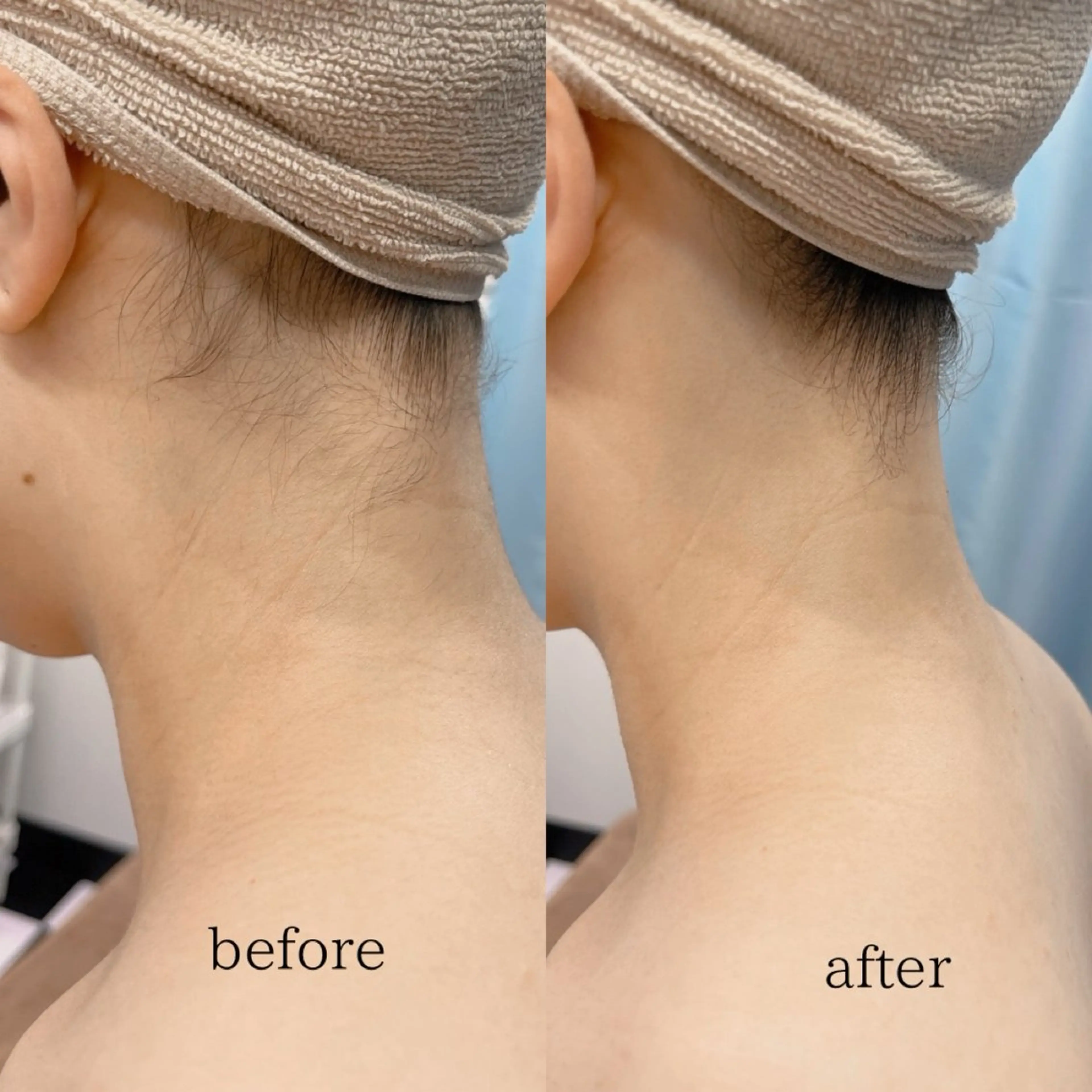 Naps-Shaving所属・敏感肌⭐️ シェービング専門佐藤の眉毛・アイブロウイメージ