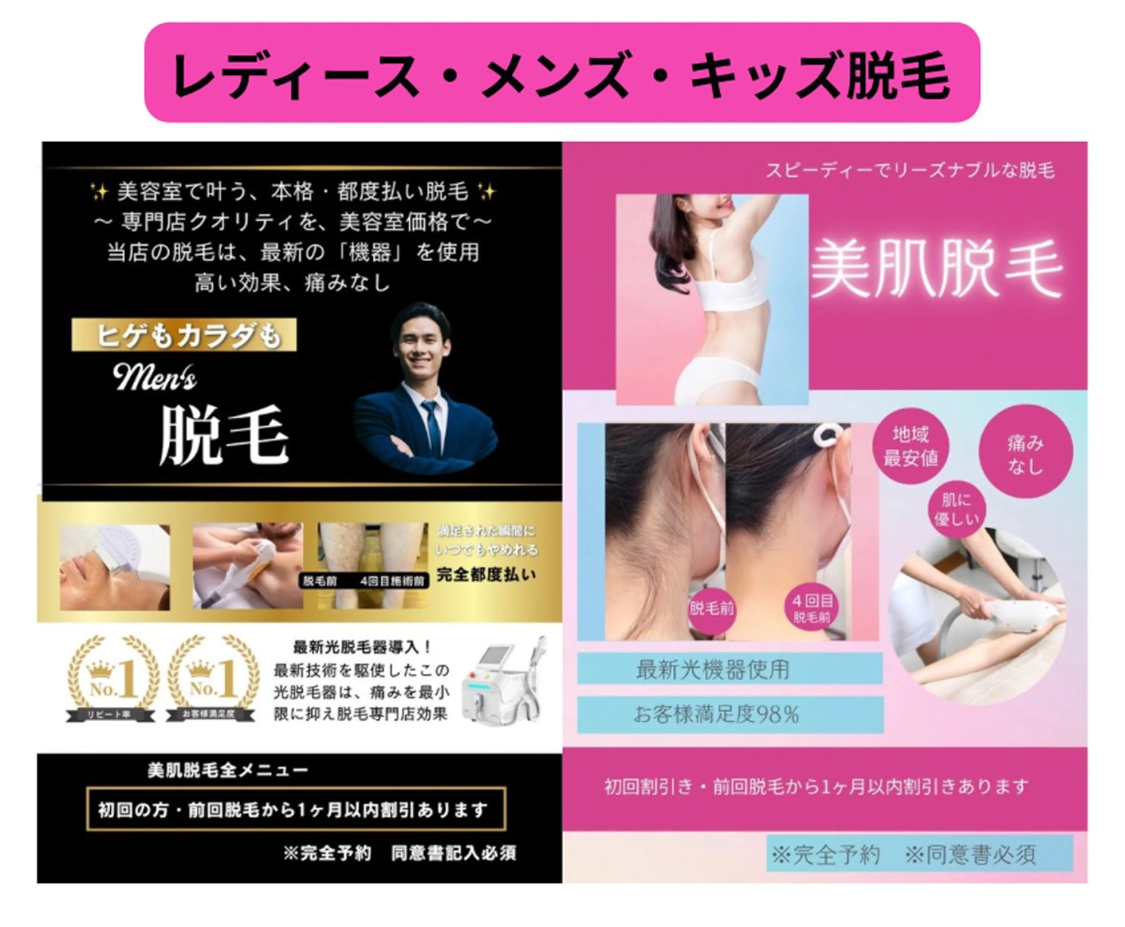 美肌脱毛【全身】（顔V I Oなし）の写真