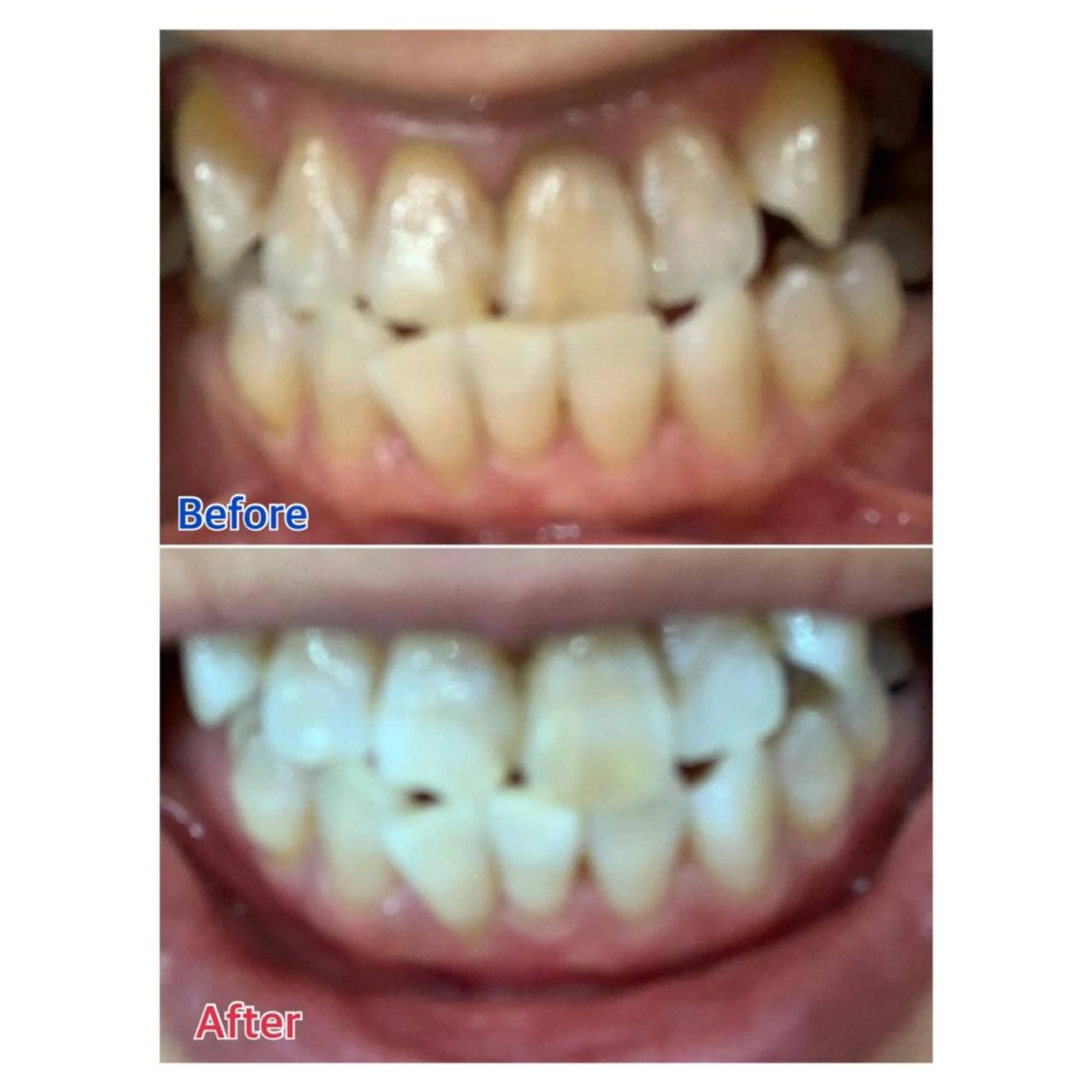 MBEAUTYSALON 千葉店・京成大久保所属・Melty 輝のその他イメージ