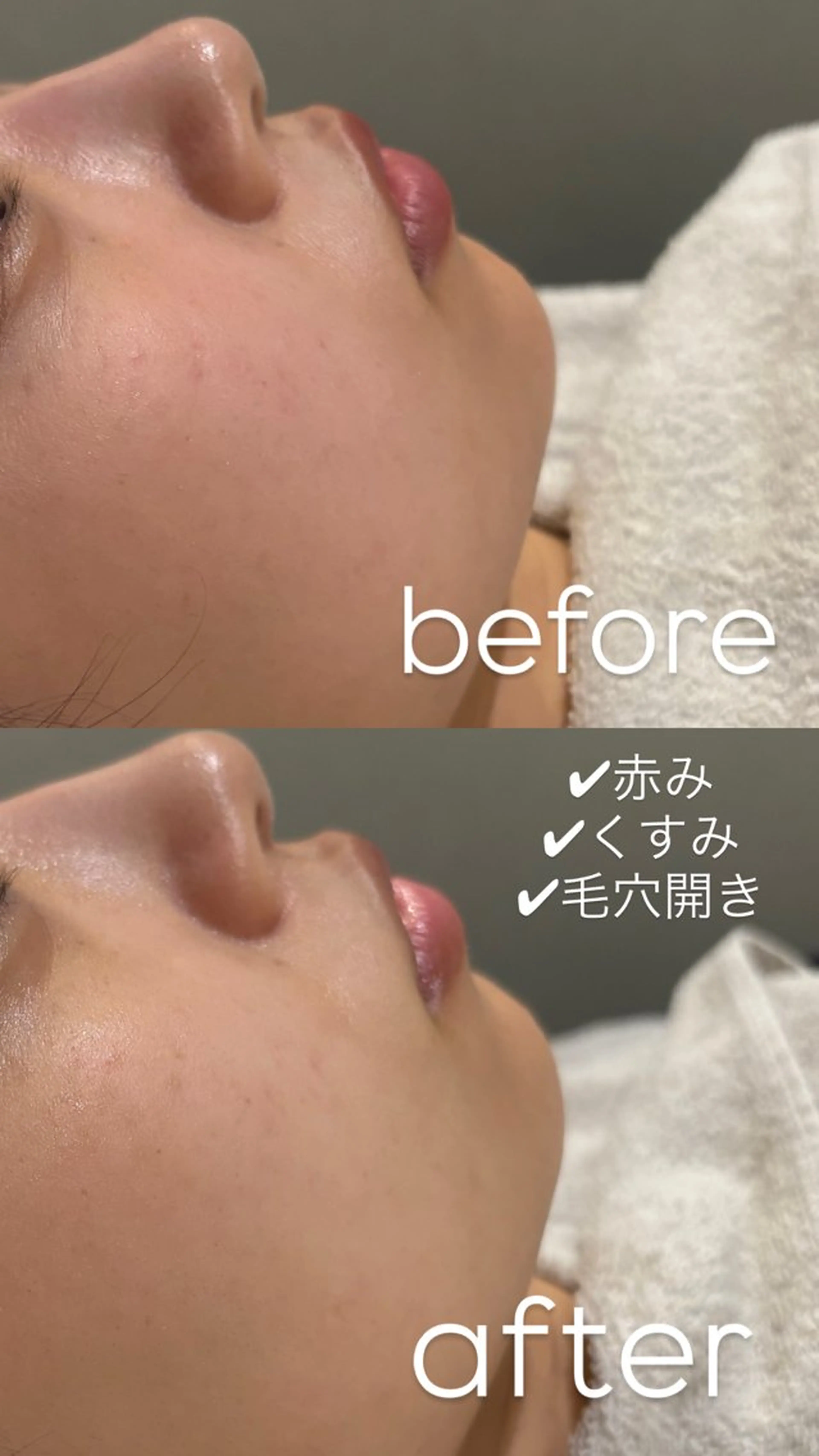 エステ リラク 【vidyto】ヴィディトゥ所属・肌管理サロン vidyto　MOEのエステ・リラクイメージ