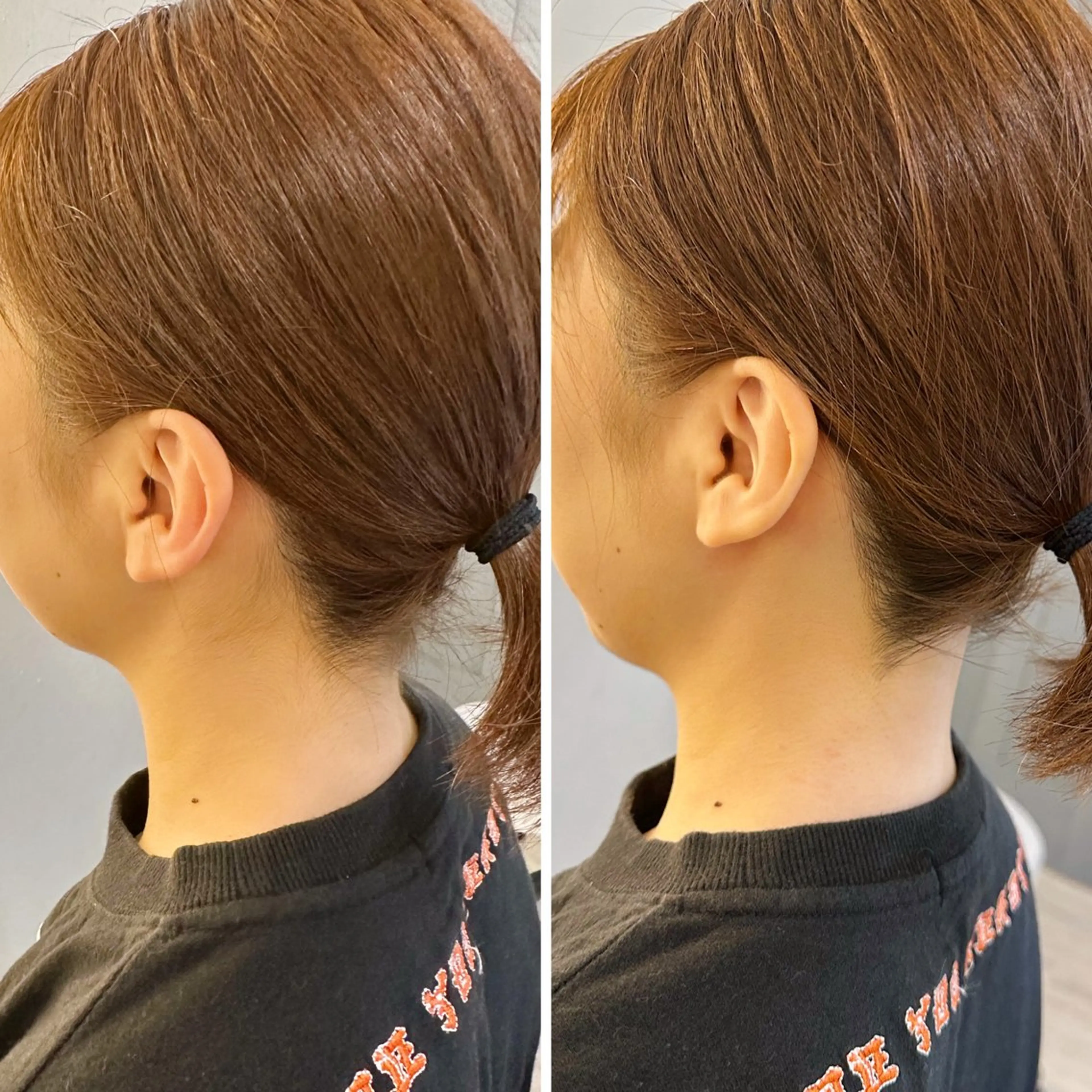 脱毛 うなじ脱毛/美肌脱毛 LABELのエステ・リラクイメージ