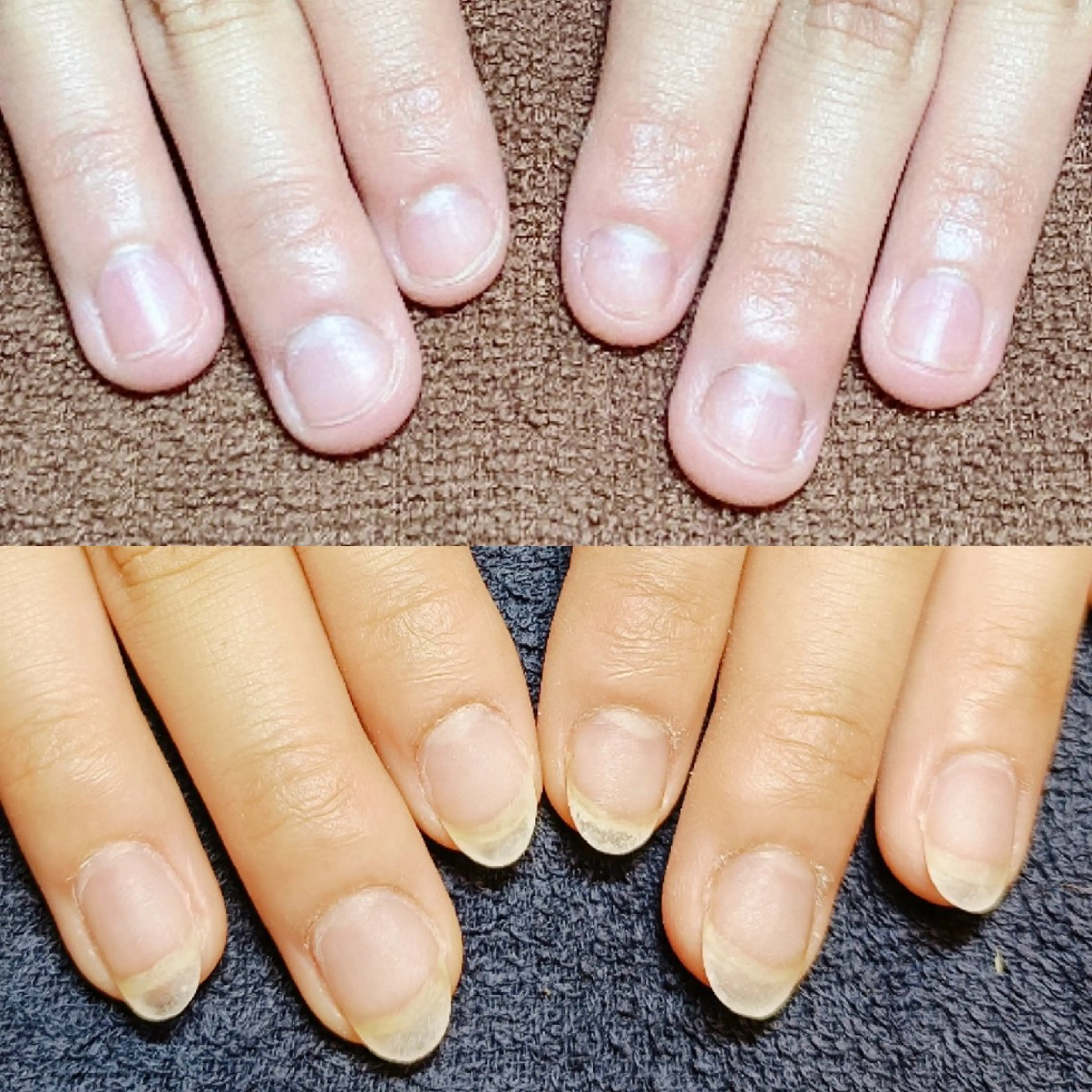 ネイル 長さ出し ハンドネイル ハンドケア 深爪矯正/爪育成ケア manie nailのネイルデザイン