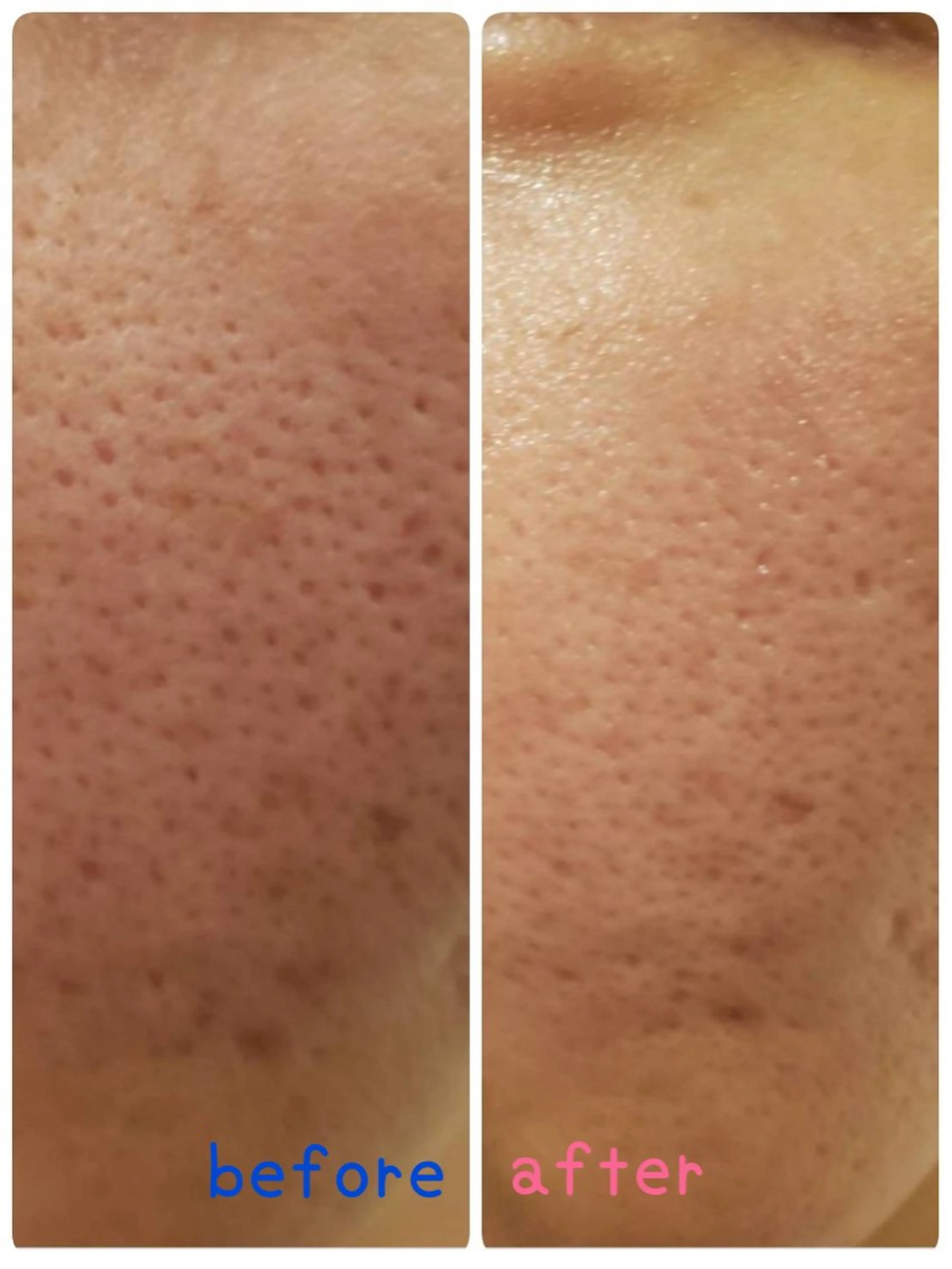 HappIness 遠赤外線ドームのエステ・リラクイメージ