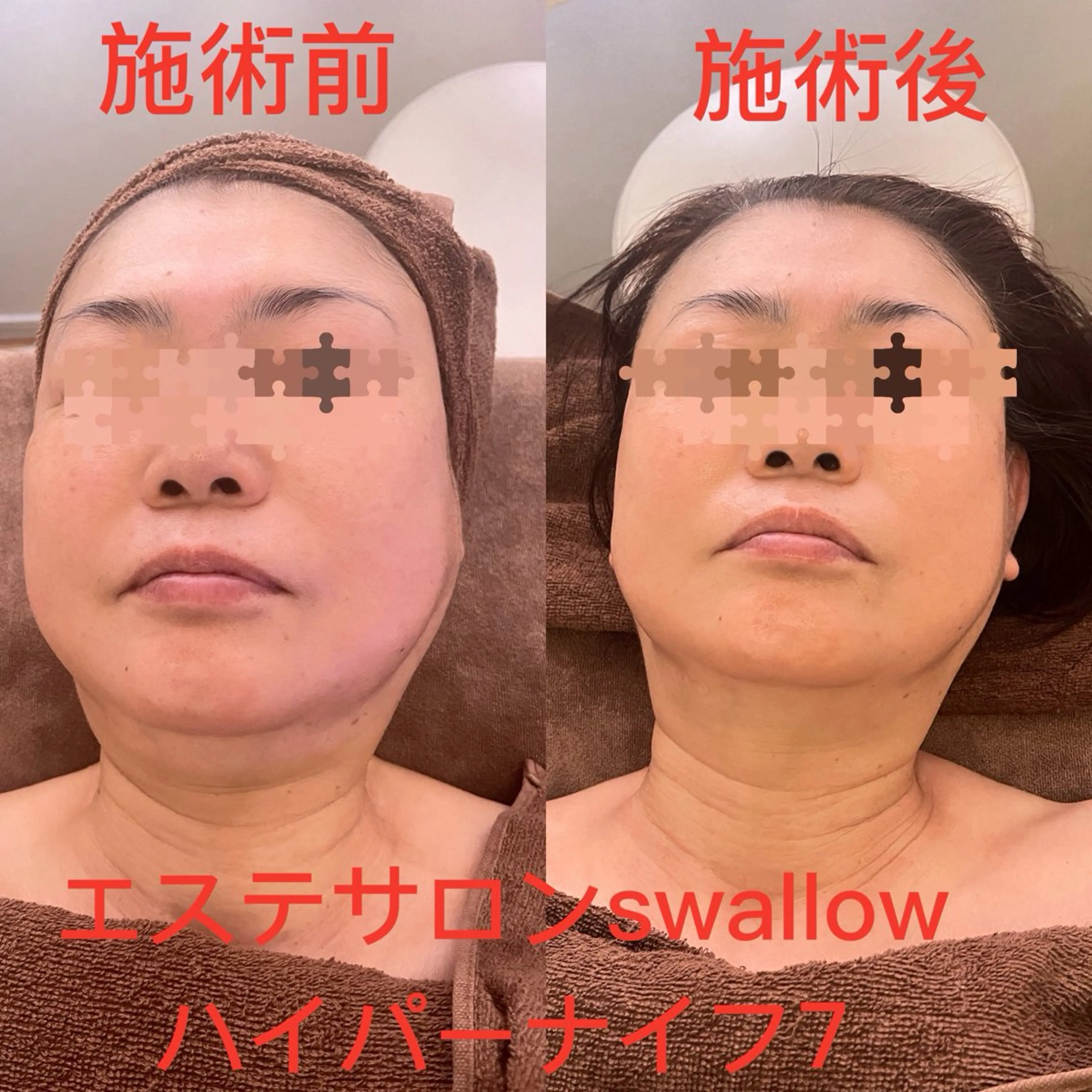 エステ リラク エステサロン swallowのエステ・リラクイメージ