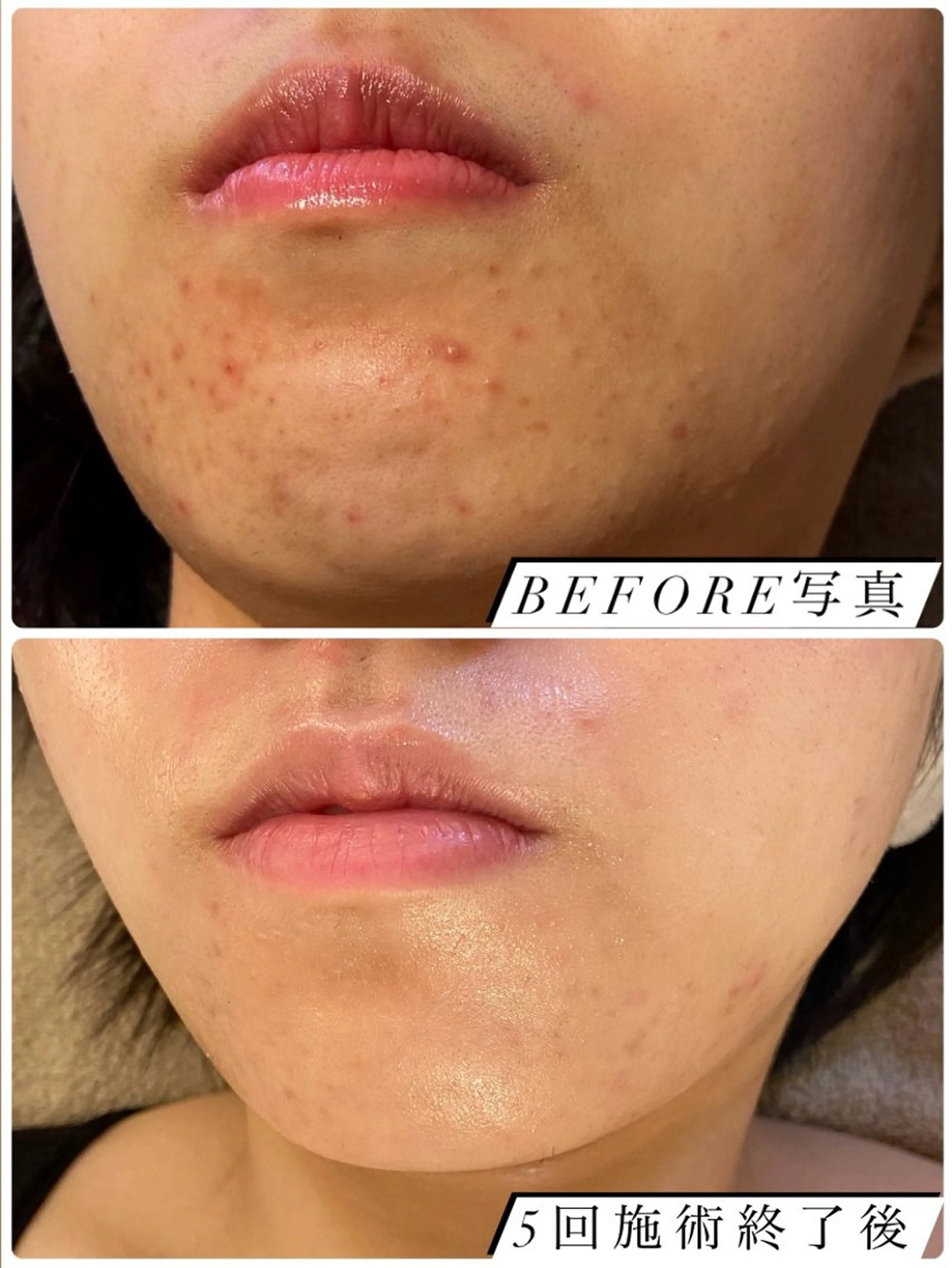 エステ リラク ホワイトニング ショップ吉祥寺2号店のその他イメージ