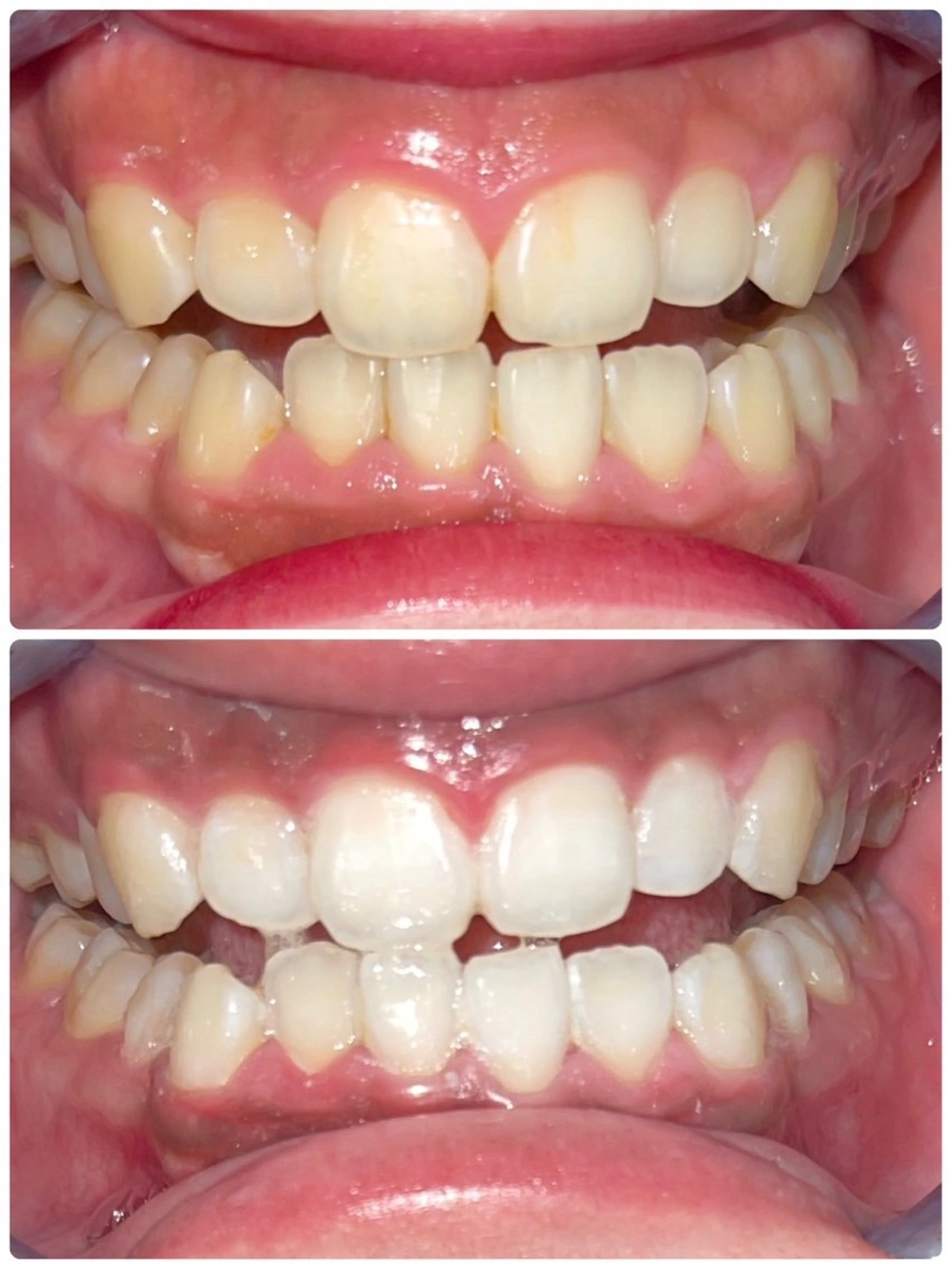 セルフホワイトニング エクシア徳島店マユのその他イメージ