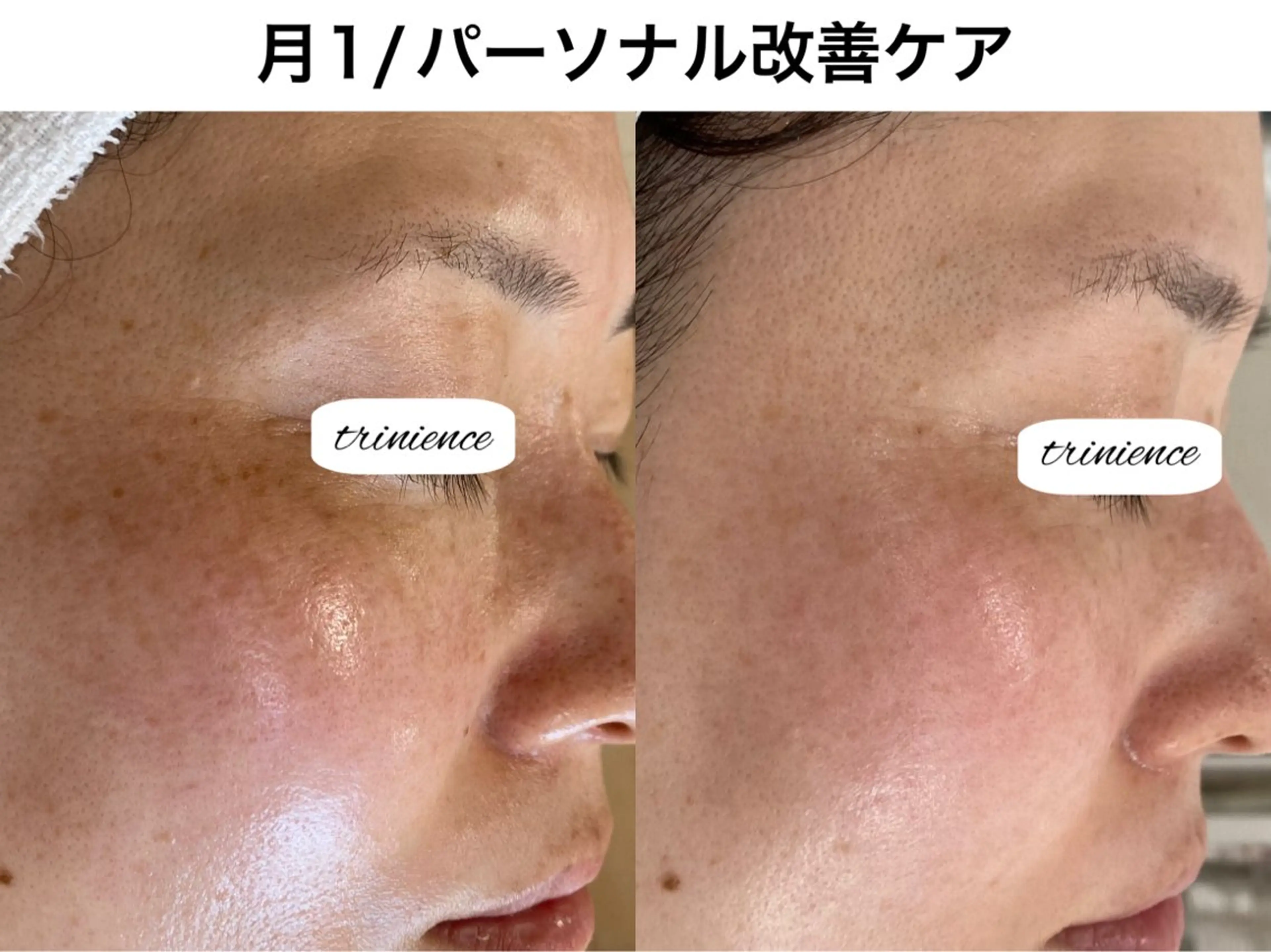 TRINIENCE 南流山店のエステ・リラクイメージ