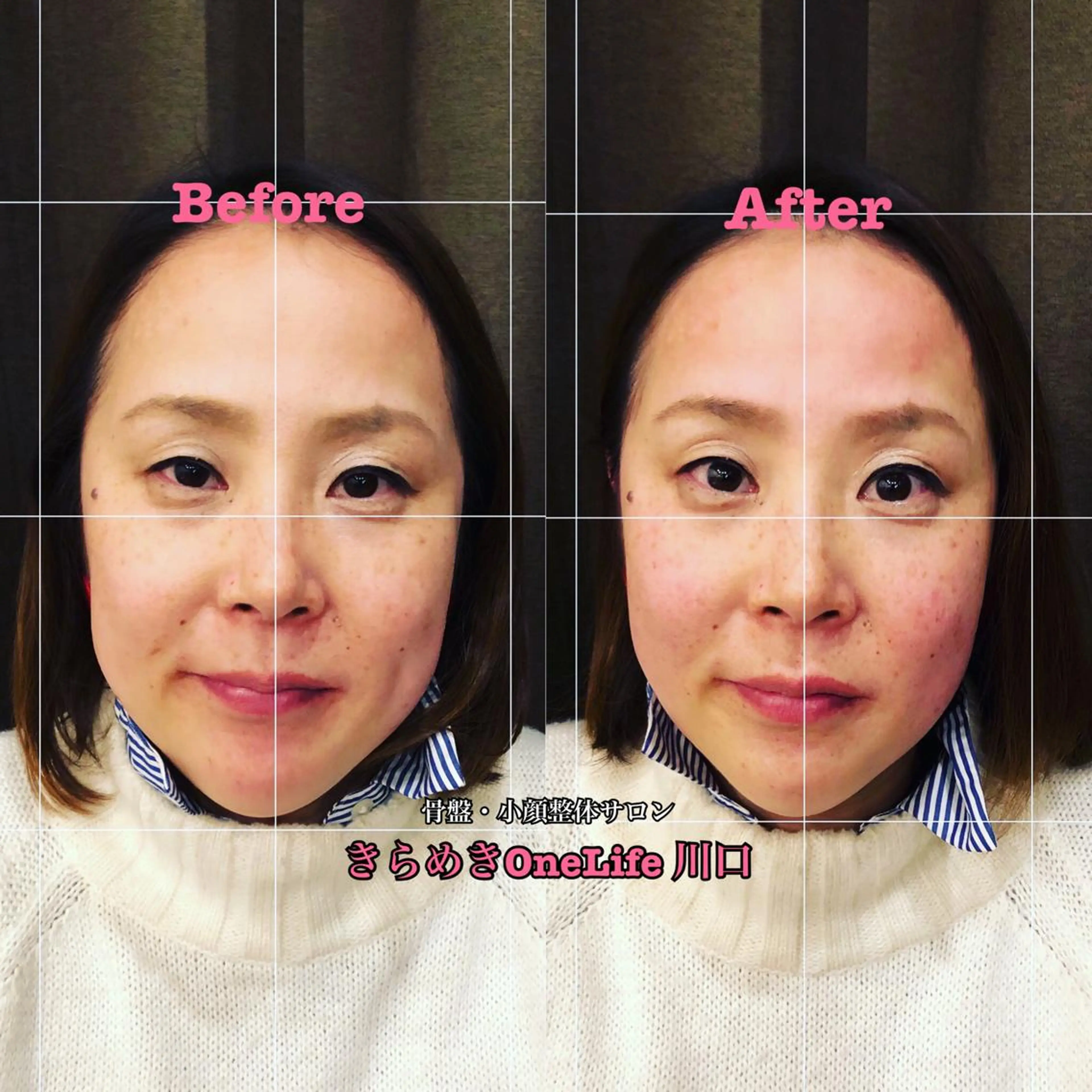 エステ リラク きらめきワンライフ Yumaのエステ・リラクイメージ