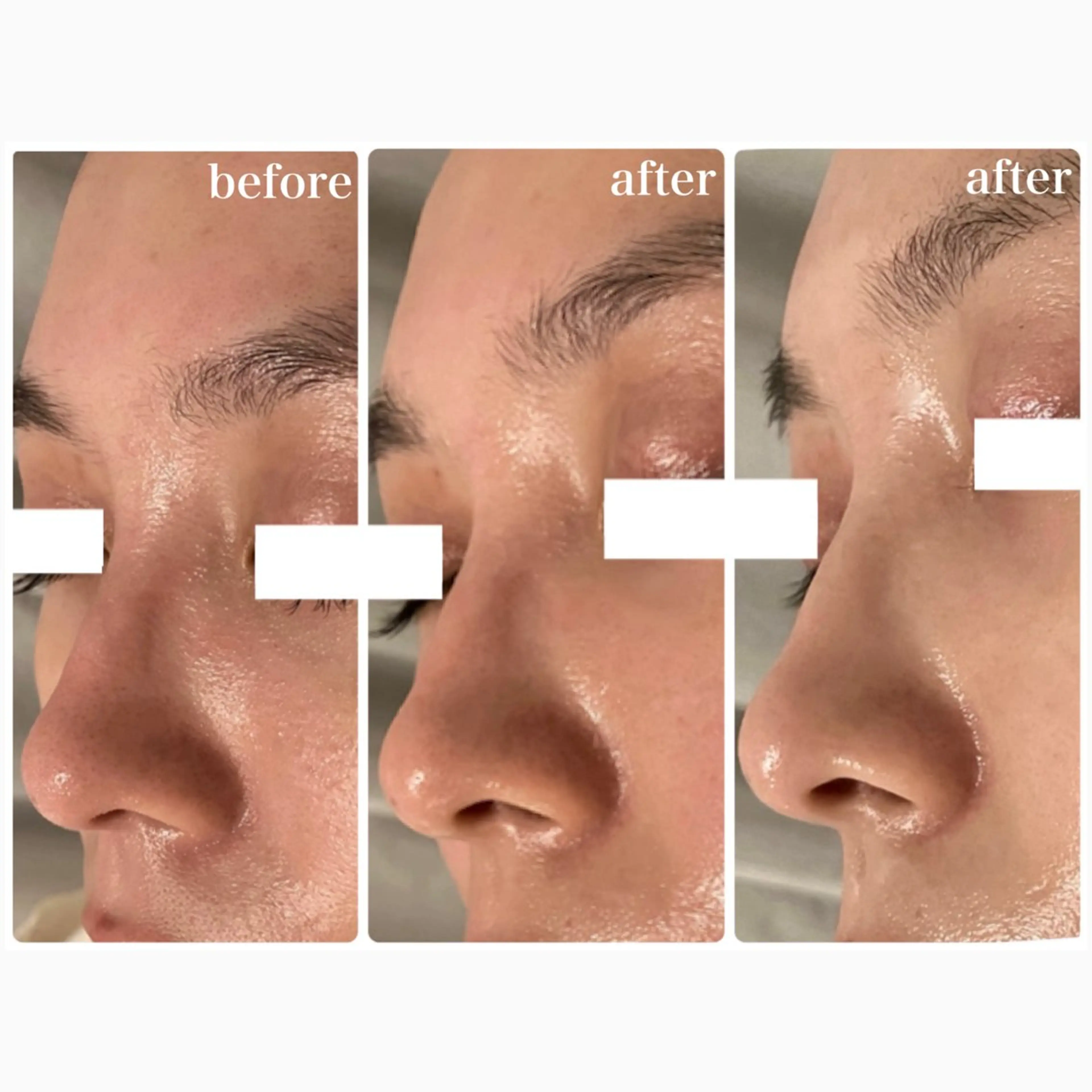 Lily branc 痩身/小顔/肌質改善のエステ・リラクイメージ