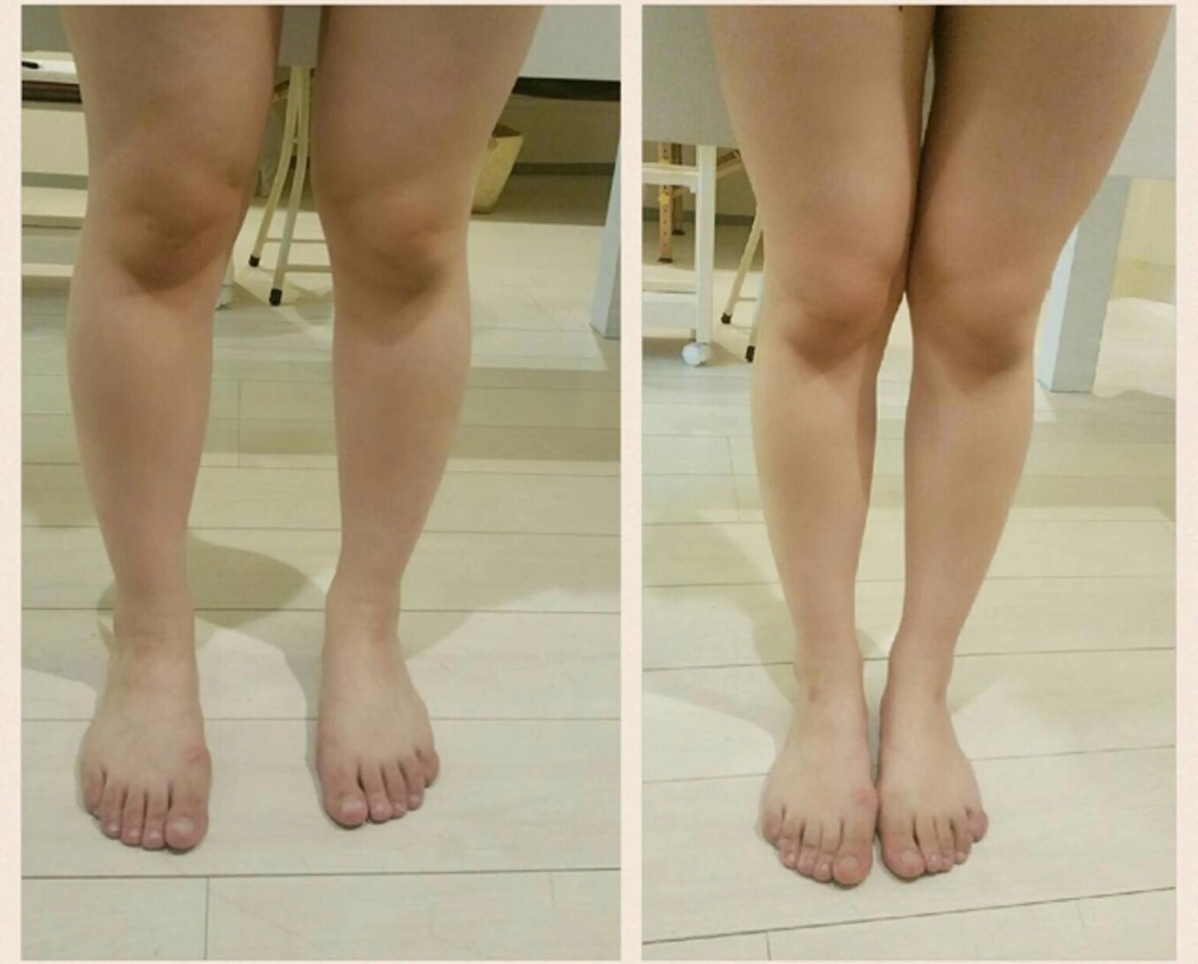 アニメ,Vオタク× 即効痩せエステサロンのエステ・リラクイメージ