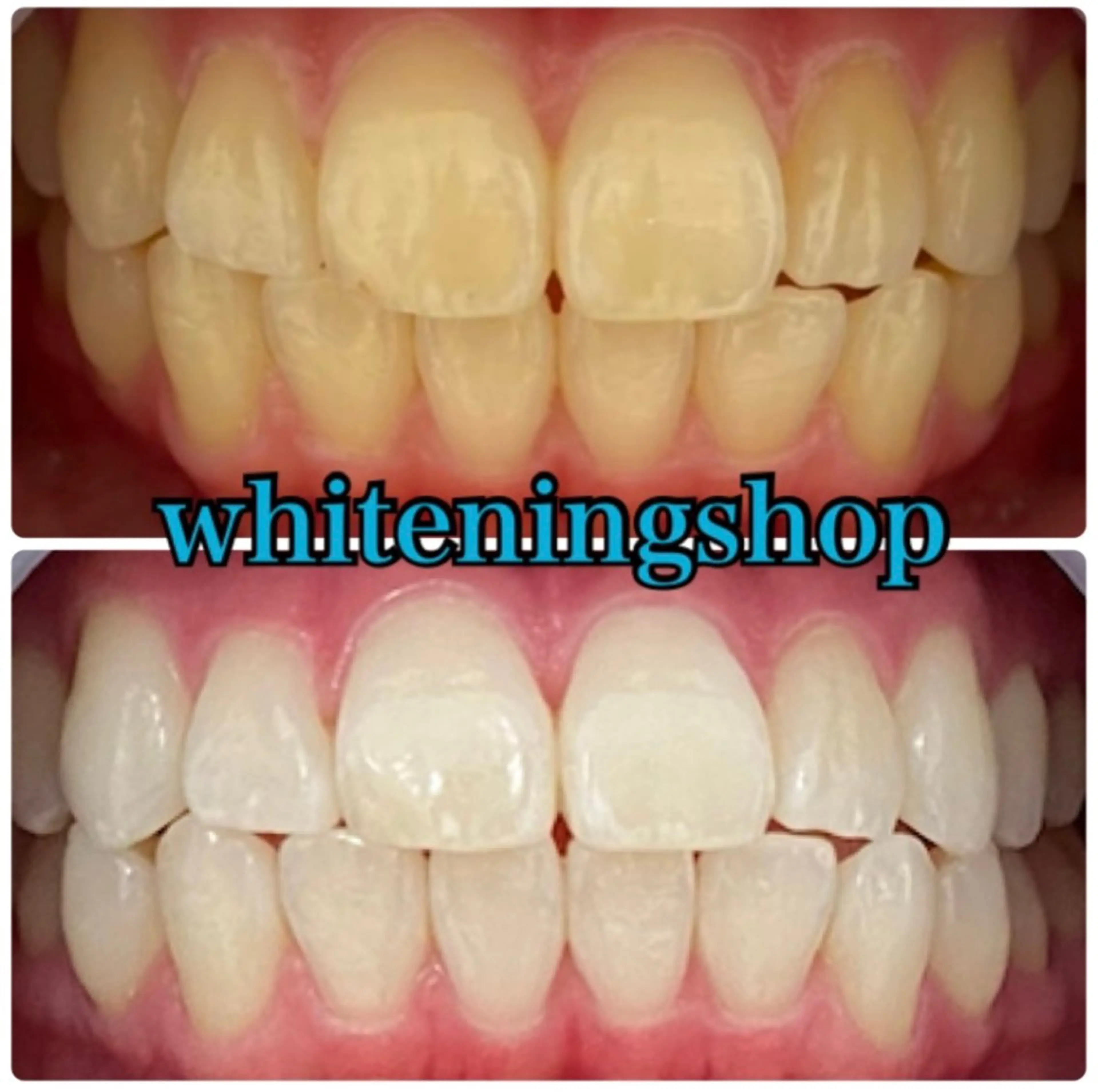 エステ リラク ホワイトニング ショップ吉祥寺店のエステ・リラクイメージ