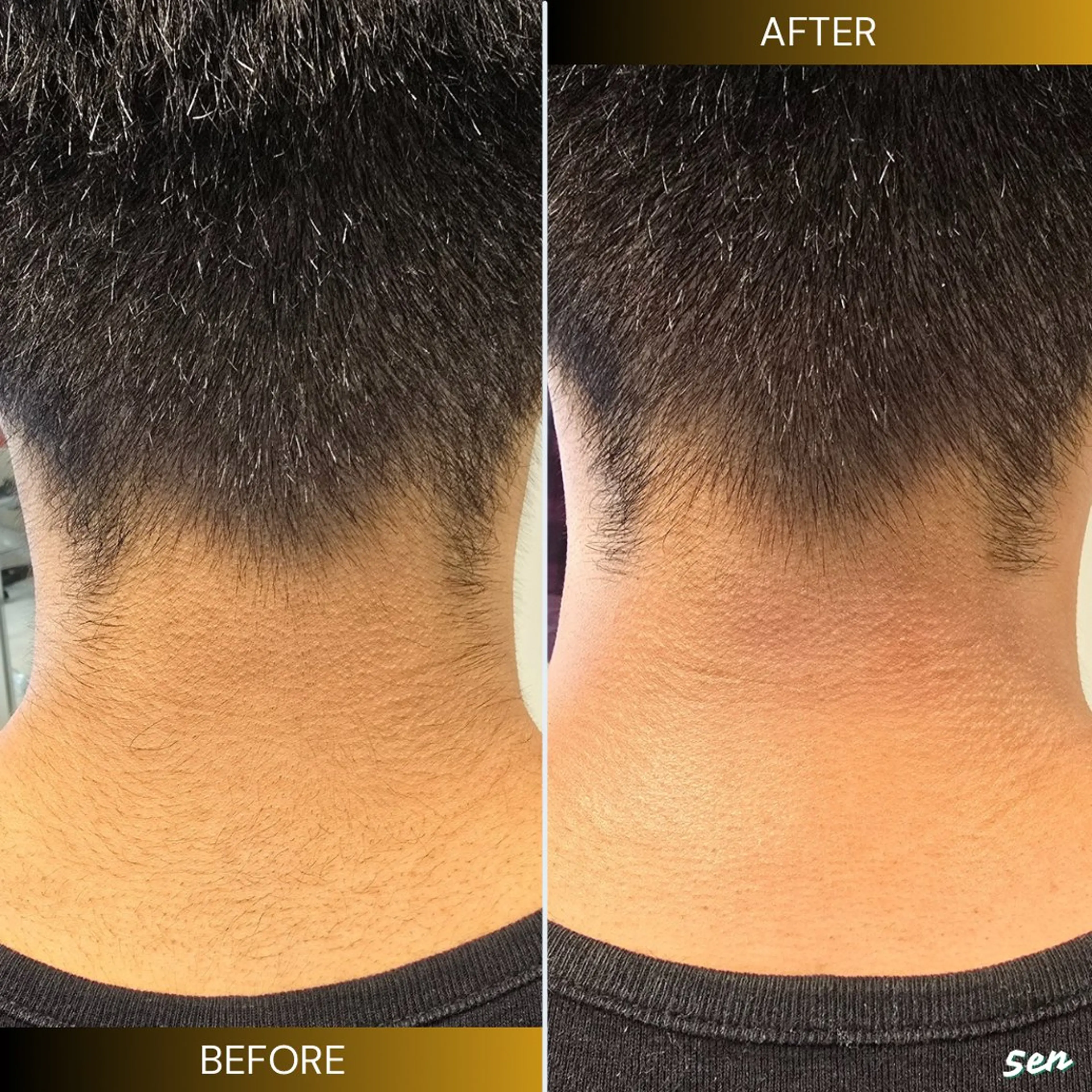 メンズ 脱毛 シュガーリング/脱毛 EARLS三軒茶屋のエステ・リラクイメージ