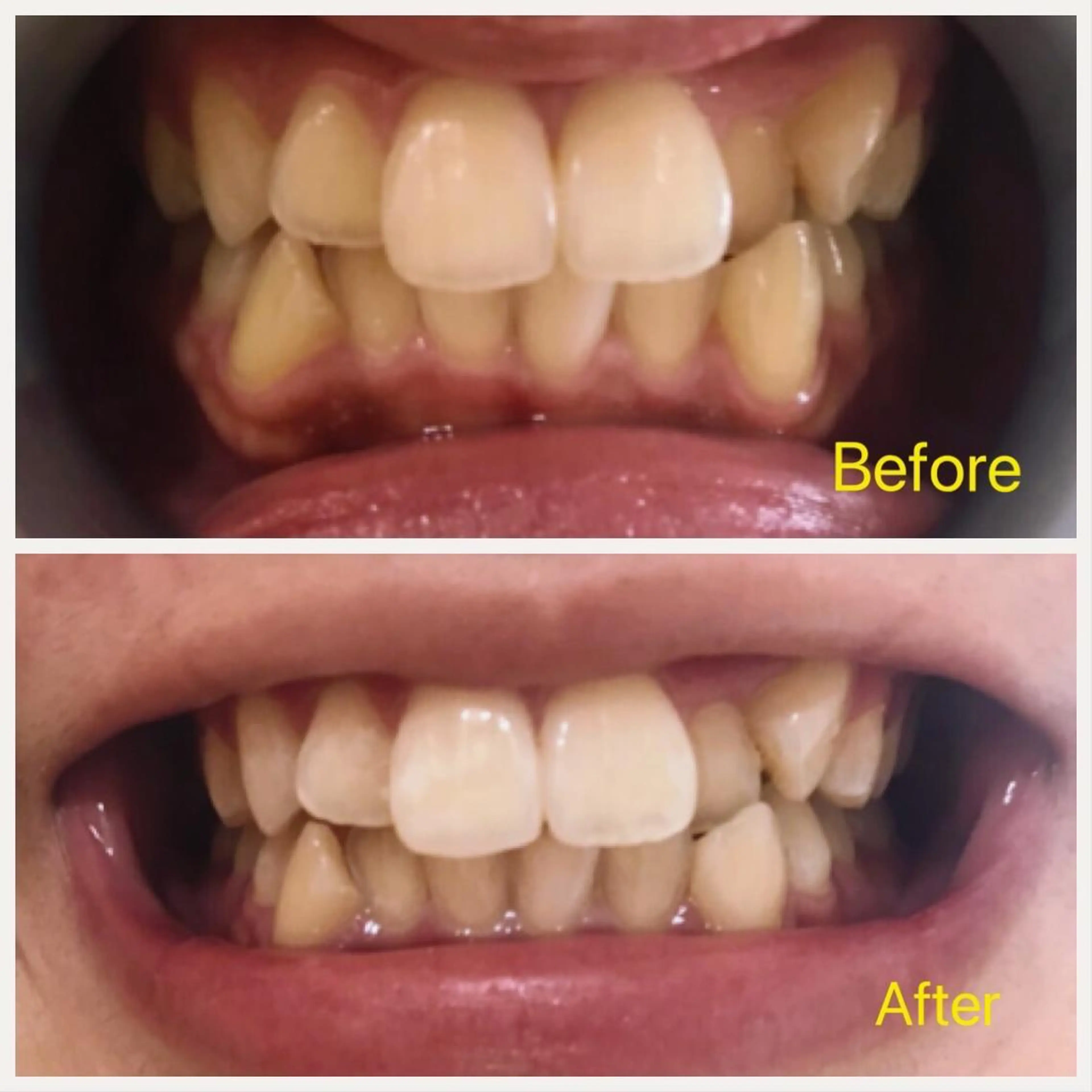 M渋谷店所属・Ｍ渋谷 ホワイトニングのエステ・リラクイメージ