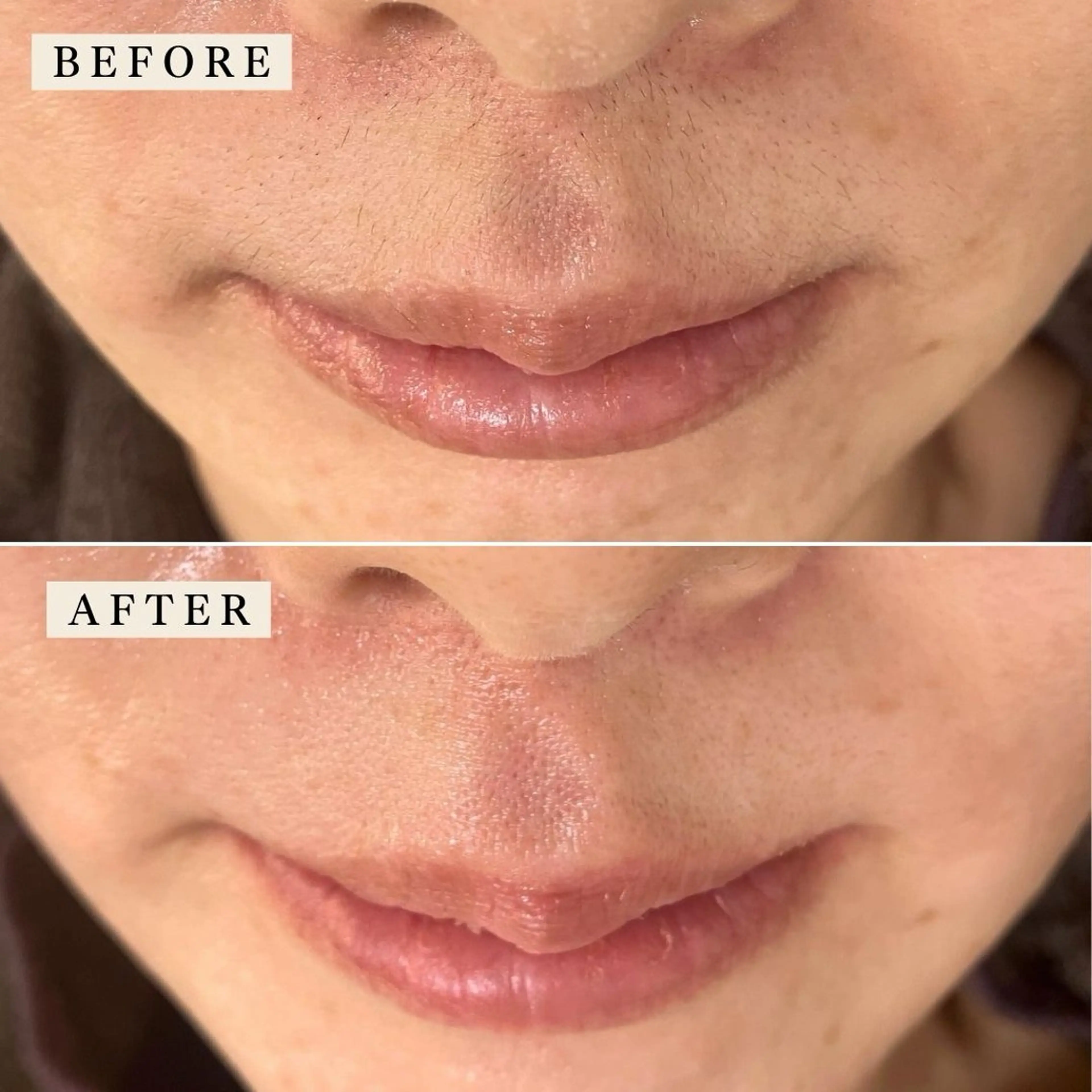 その他 【産毛・眉毛ケア＆肌質改善サロン】＊BiBi＊beautysalon所属・眉･産毛専門BiBi 糸脱毛スレッティングのエステ・リラクイメージ