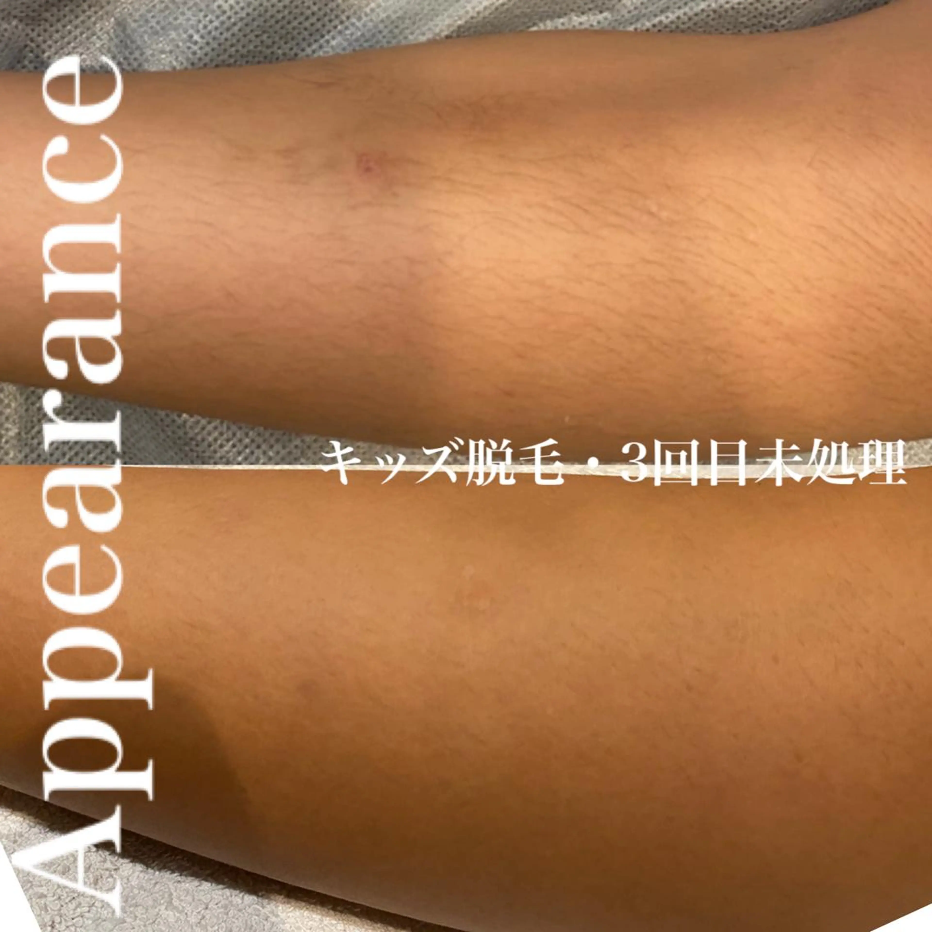 Appearance所属・Appearance 【アピアランス】のエステ・リラクイメージ