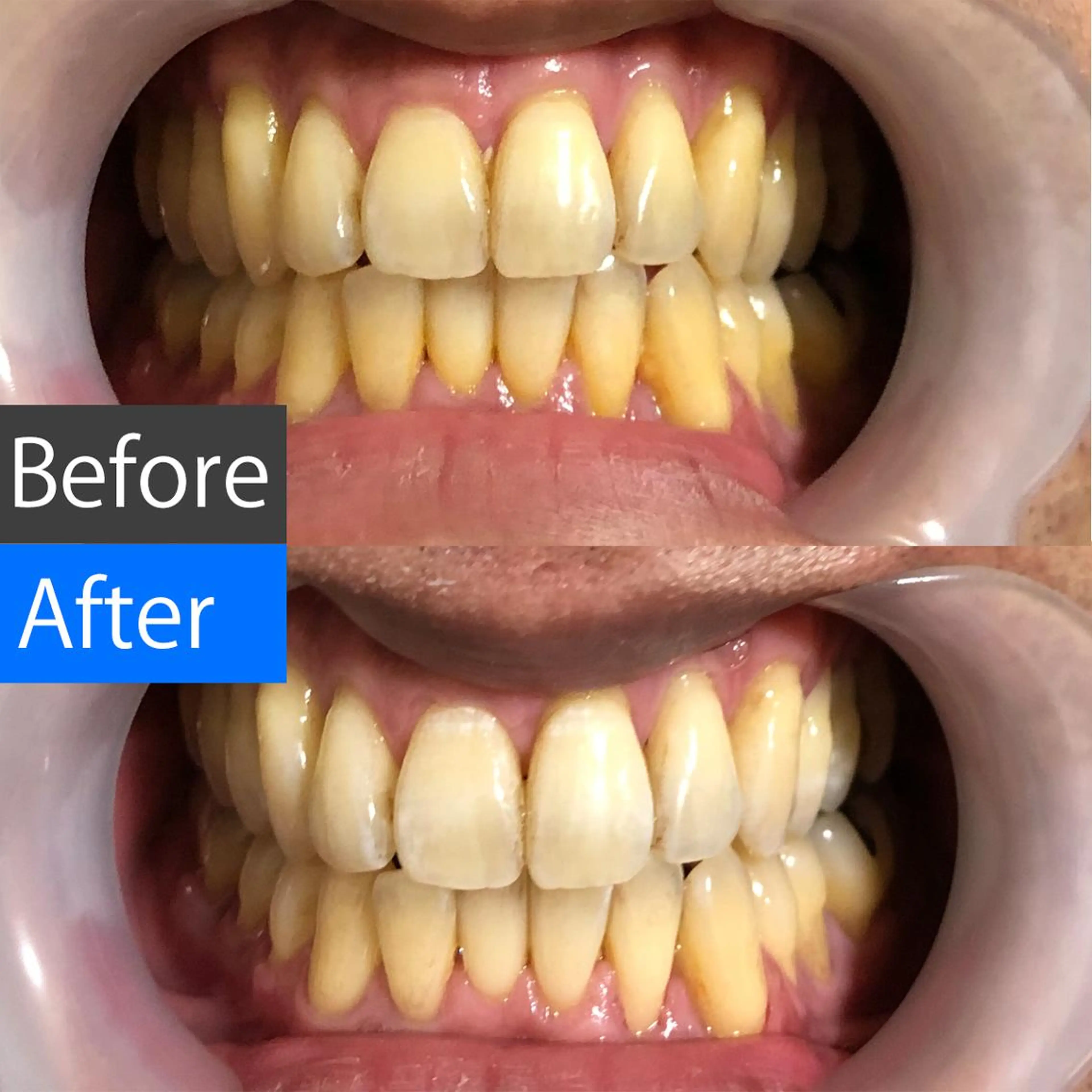 ショート カラー キッズ パーマ ネイル ヘアアレンジ マツエク・マツパ メンズ アイブロウ ホワイト 中目黒 ホワイトニングサロンのその他イメージ