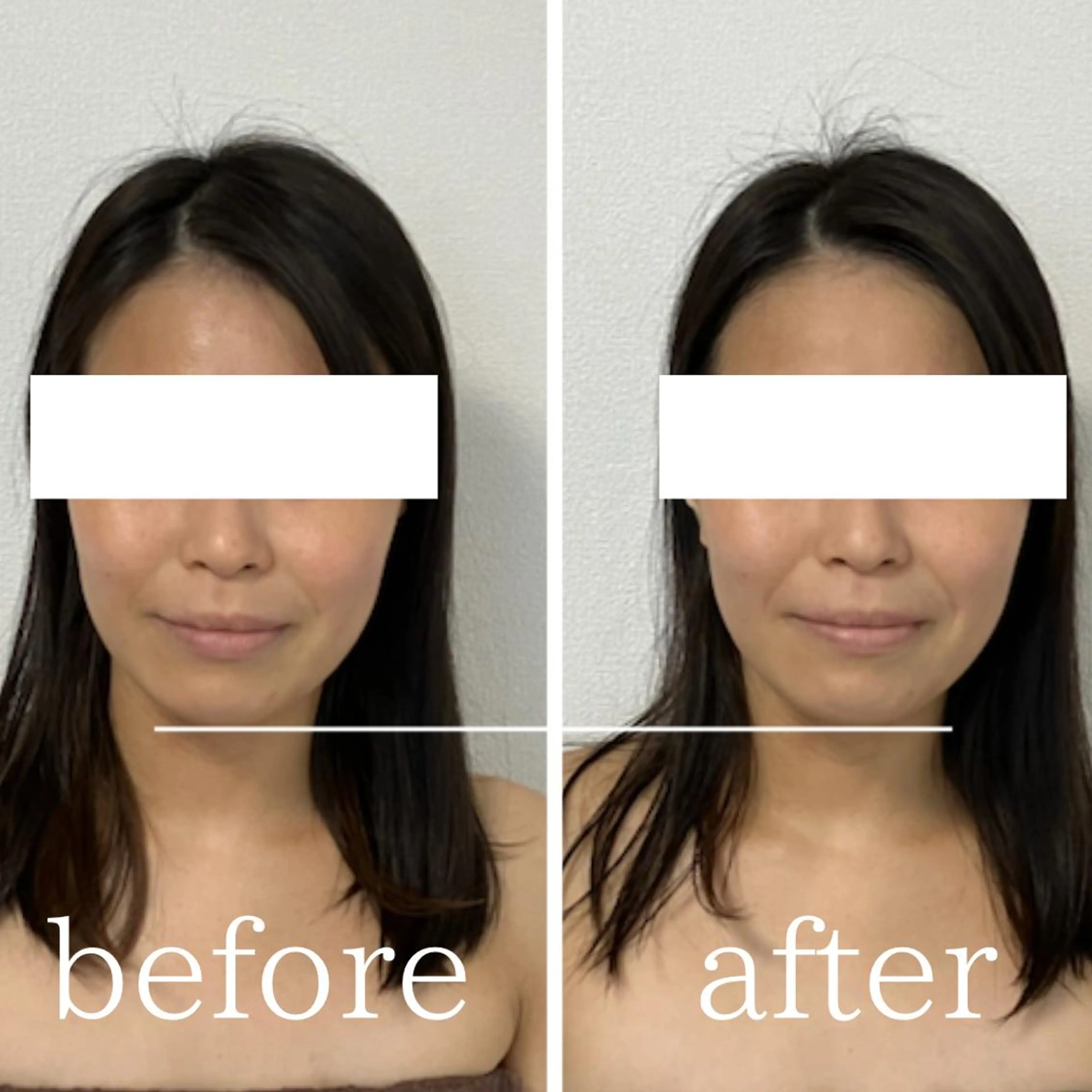 毛穴肌質ケアサロン Yourmeユアミーのエステ・リラクイメージ