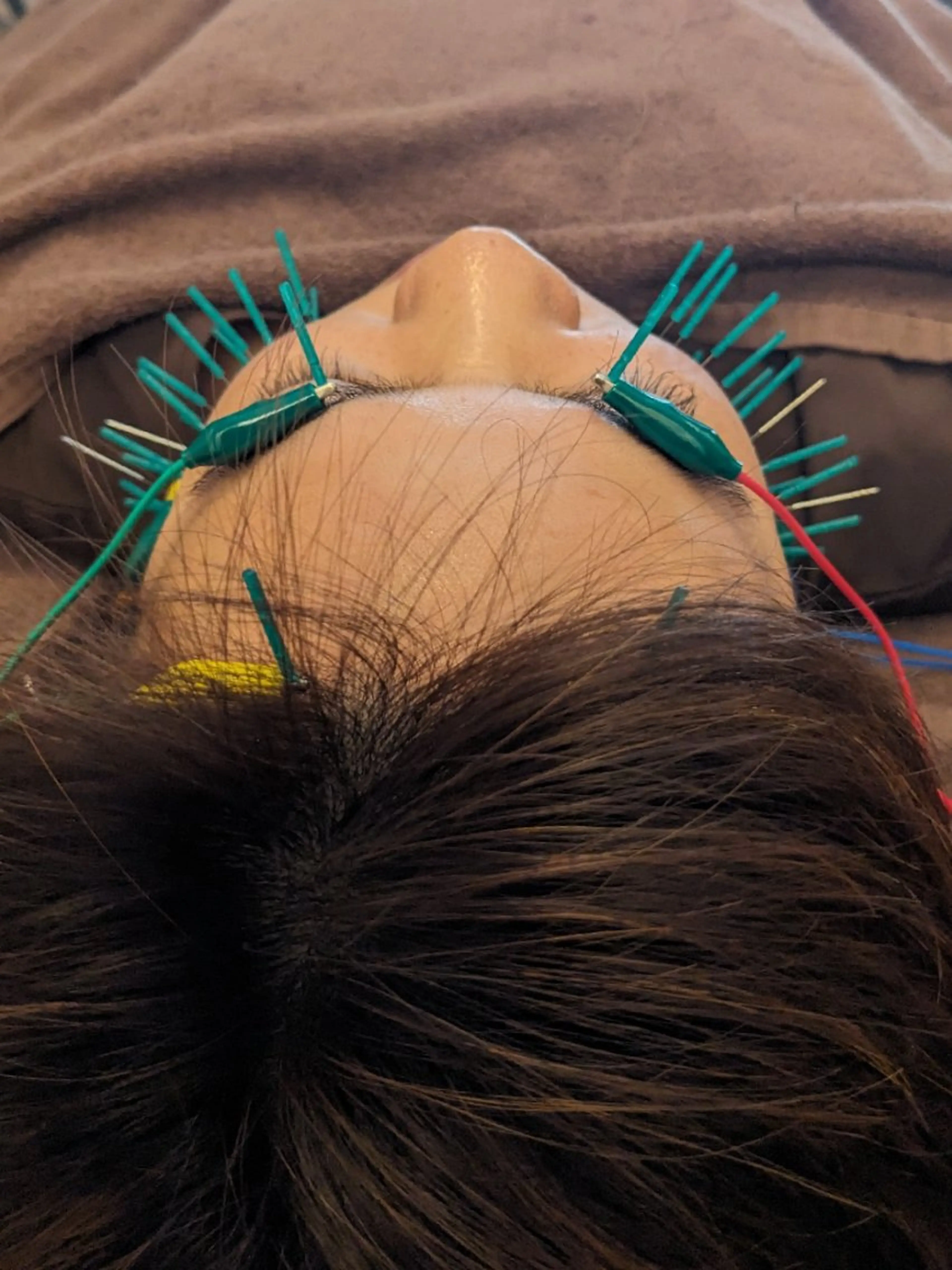 リラク 乃々鍼灸・整体院　表参道所属・乃々鍼灸整体院　植木 　【美容鍼/整体】のエステ・リラクイメージ