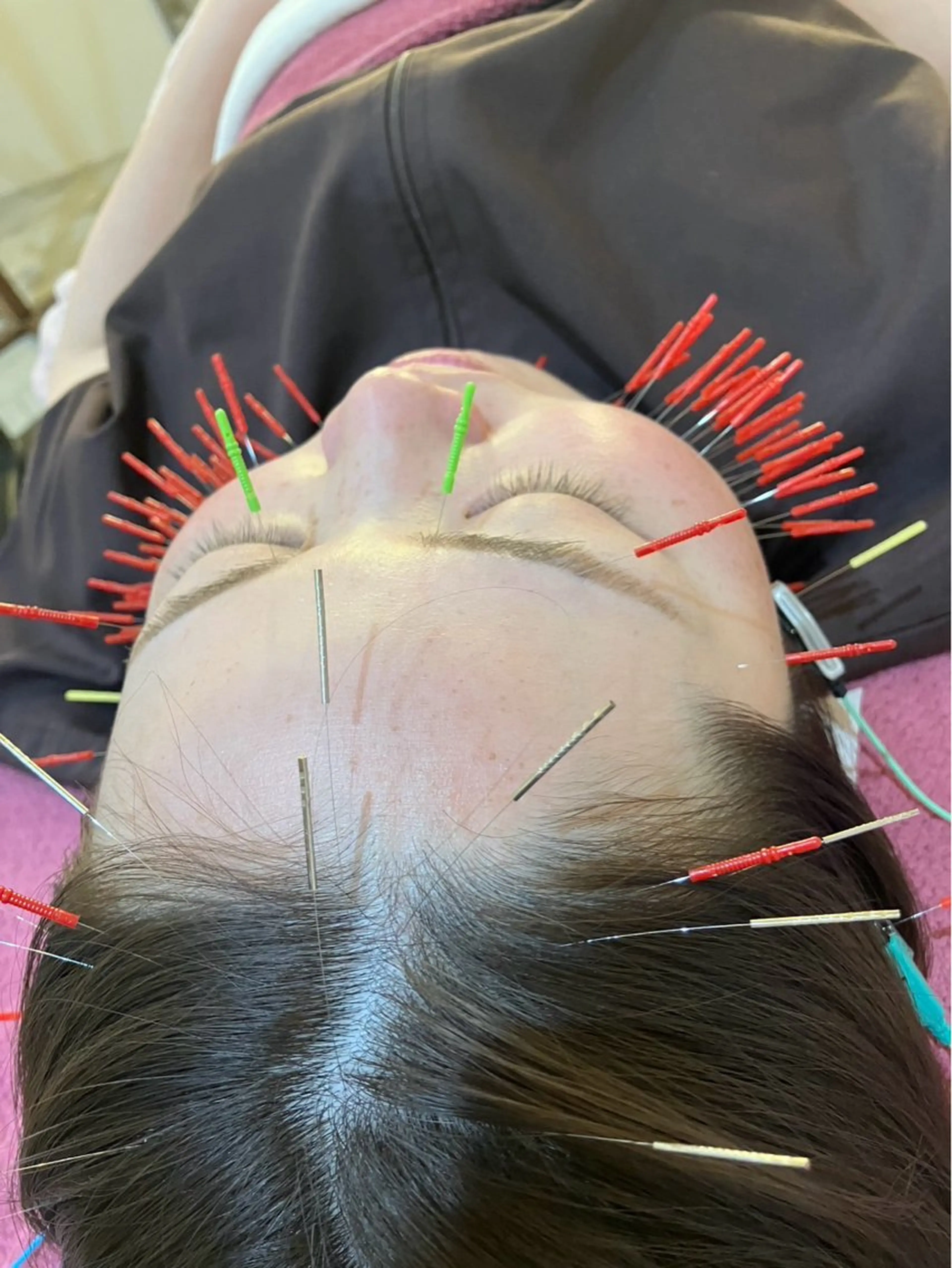 エステ リラク 美容鍼灸女性専用 りんご鍼灸治療院のその他イメージ