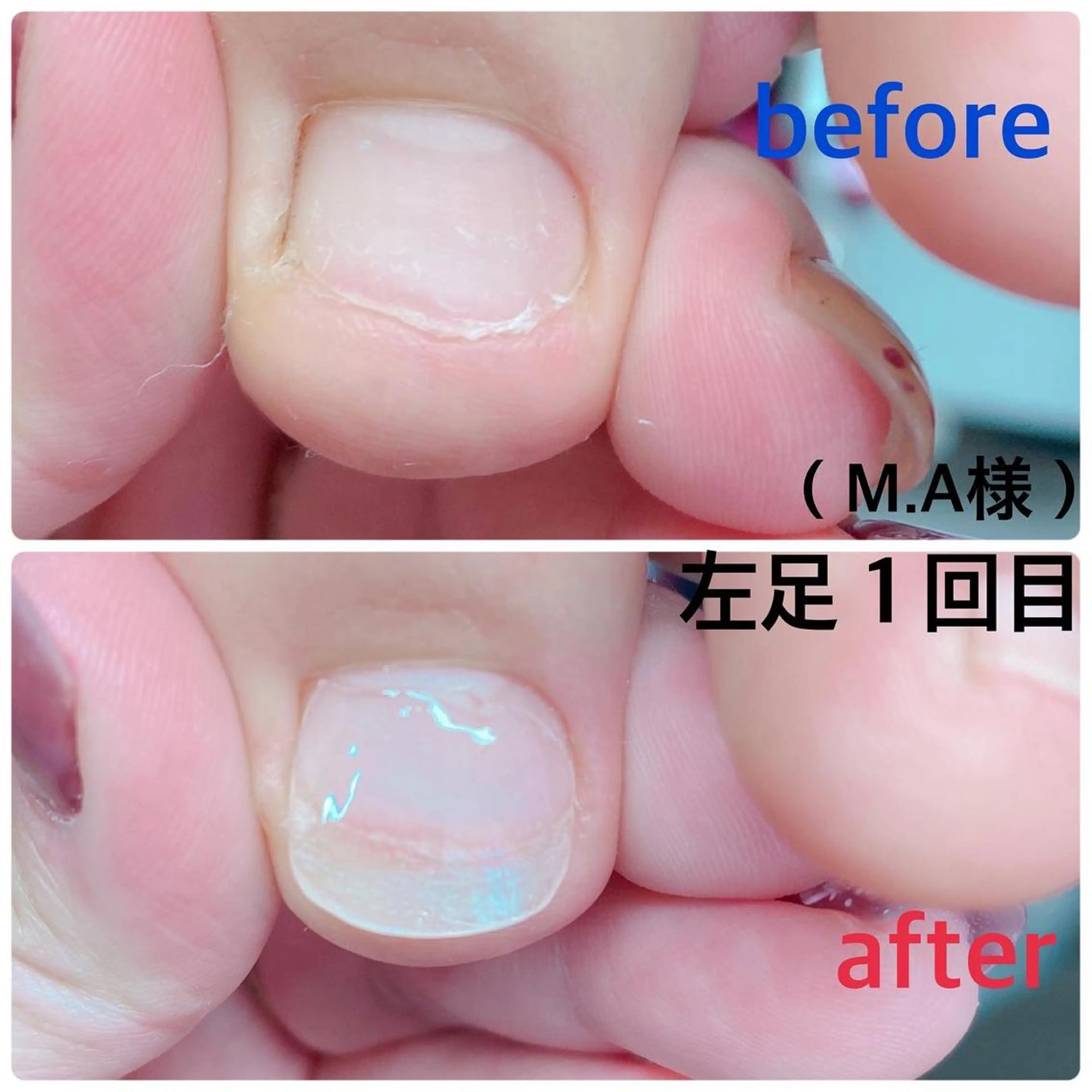 ネイル フットネイル 柴崎 美幸のネイルデザイン