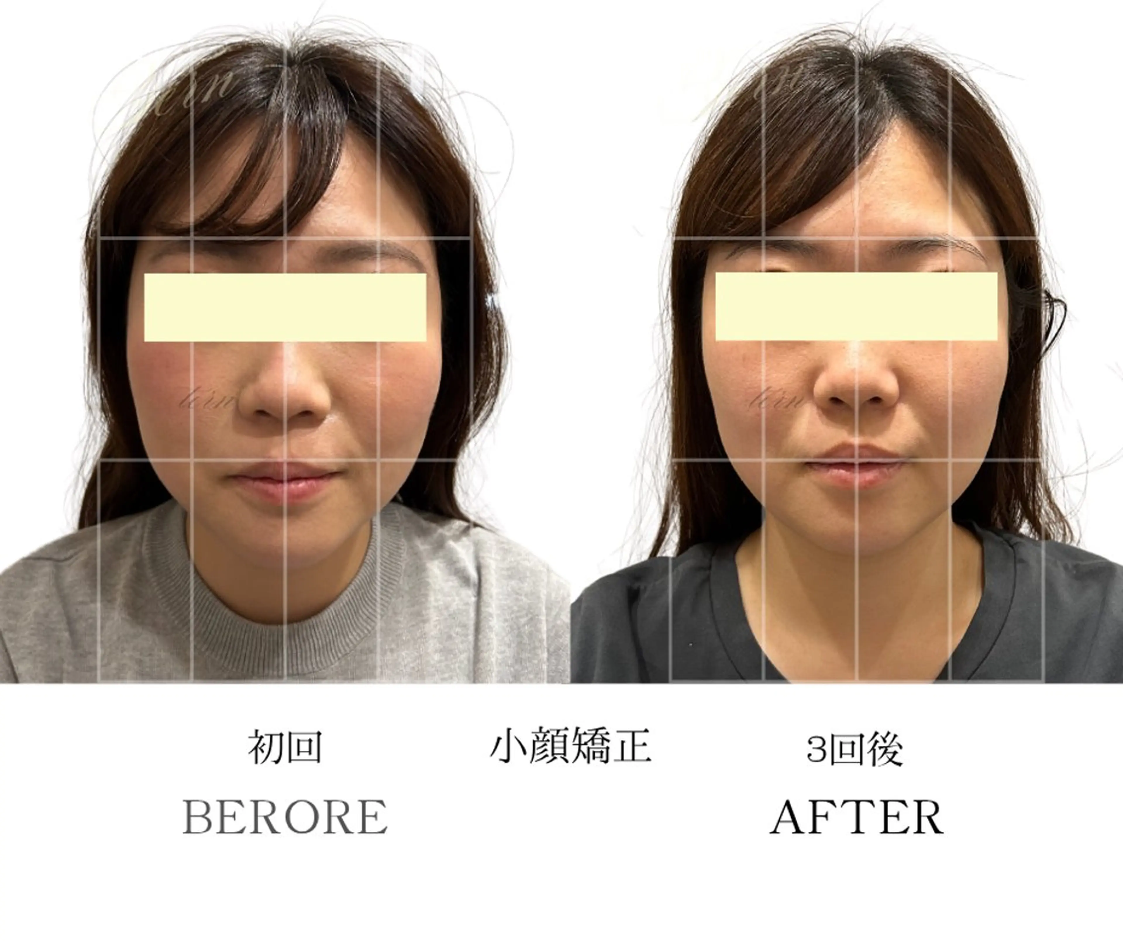 エステ 小顔・ニキビ・肌管理 TERN 南草津店のエステ・リラクイメージ