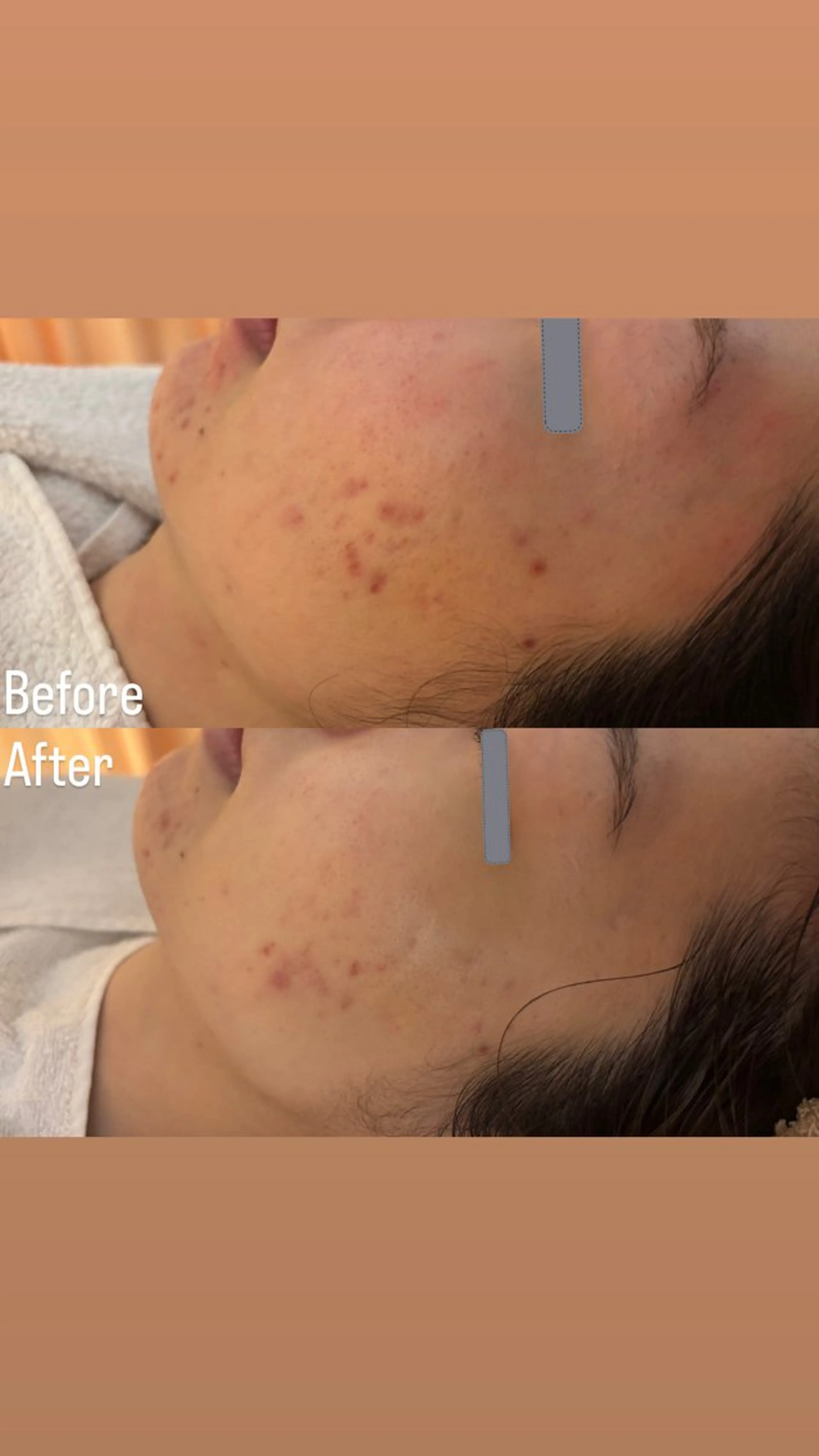 エステ リラク デアイム東広島所属・中井 小春のエステ・リラクイメージ