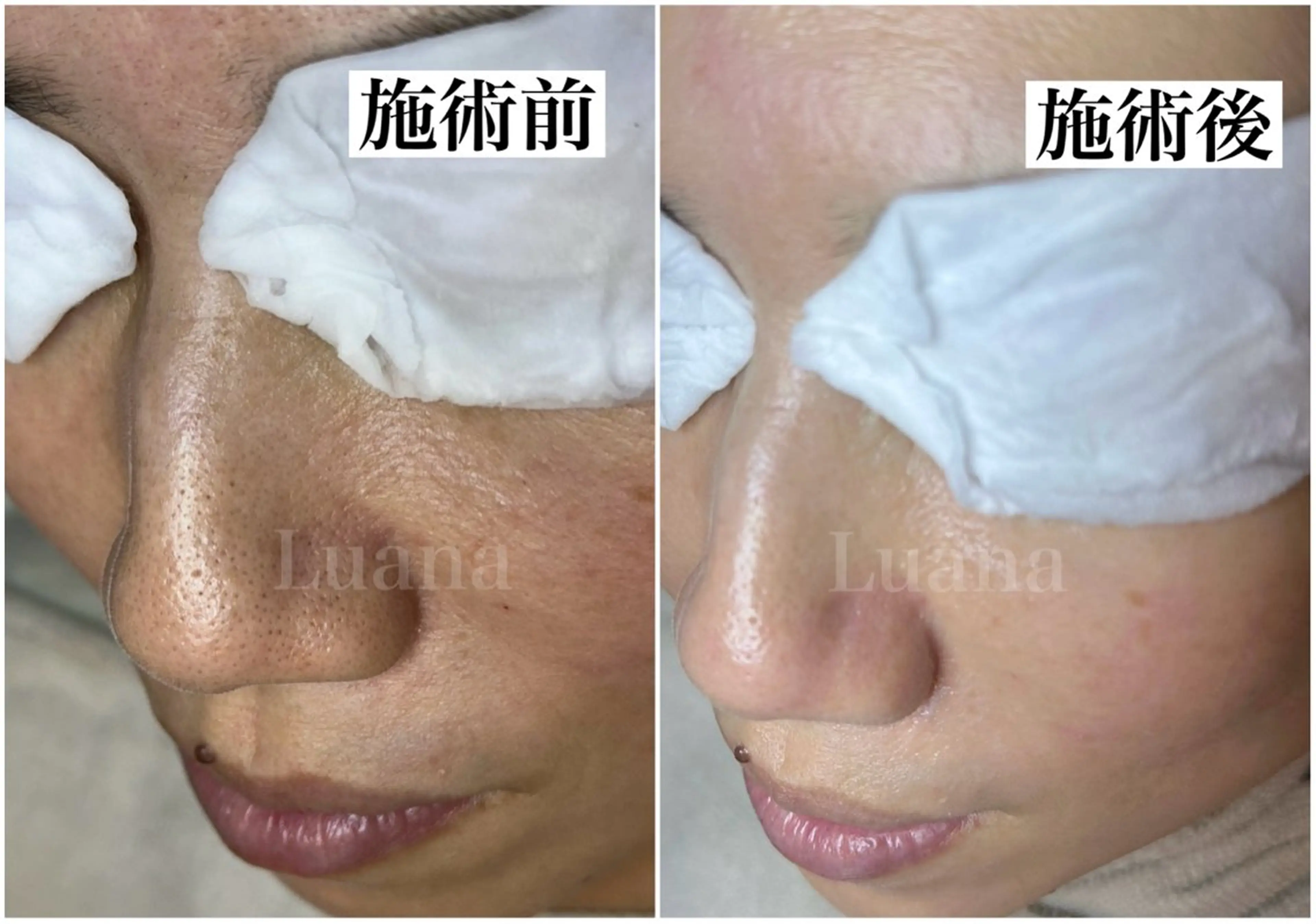 マツヤニWax専門/ 岸和田/Luanaのエステ・リラクイメージ